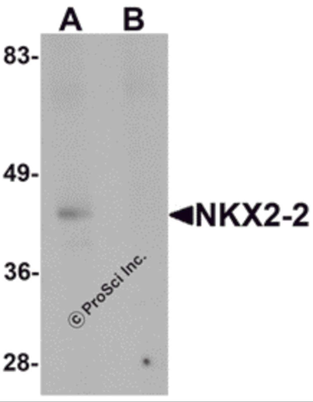 Western blot analysis of NKX2-2 in rat kidney tissue lysate with NKX2-2 antibody at 1 μg/mL in (A) the absence and (B) the presence of blocking peptide.