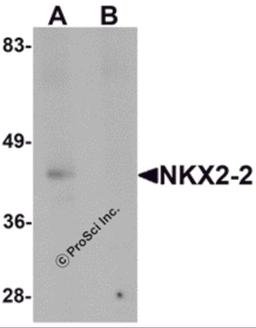 Western blot analysis of NKX2-2 in rat kidney tissue lysate with NKX2-2 antibody at 1 μg/mL in (A) the absence and (B) the presence of blocking peptide.