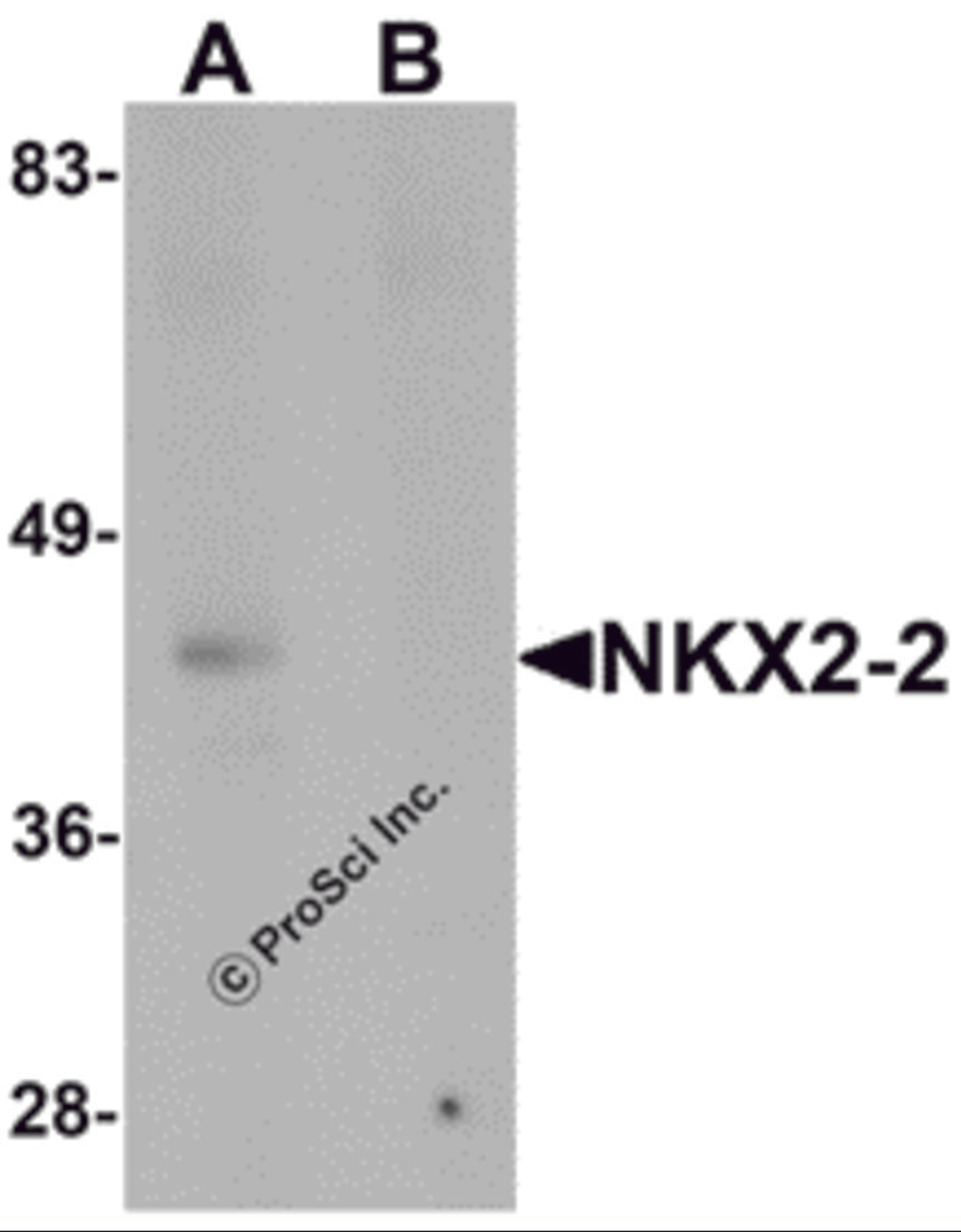 Western blot analysis of NKX2-2 in rat kidney tissue lysate with NKX2-2 antibody at 1 μg/mL in (A) the absence and (B) the presence of blocking peptide.