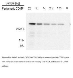 Western Blot: COMP Antibody (MA37C94 (HC484D1)) [NB100-64779] - Purifed COMP from conditioned media. Image from verified customer review.