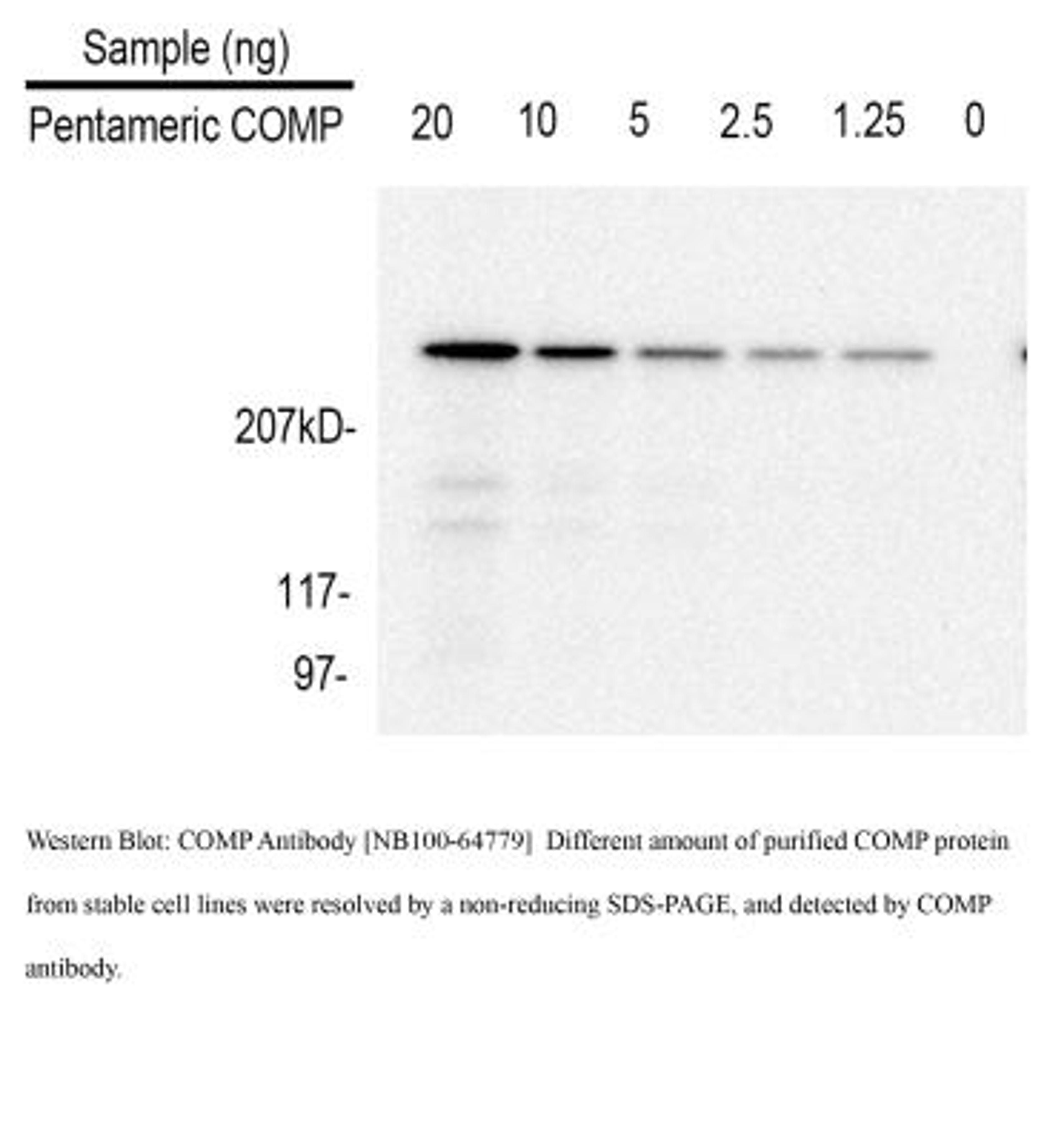 Western Blot: COMP Antibody (MA37C94 (HC484D1)) [NB100-64779] - Purifed COMP from conditioned media. Image from verified customer review.