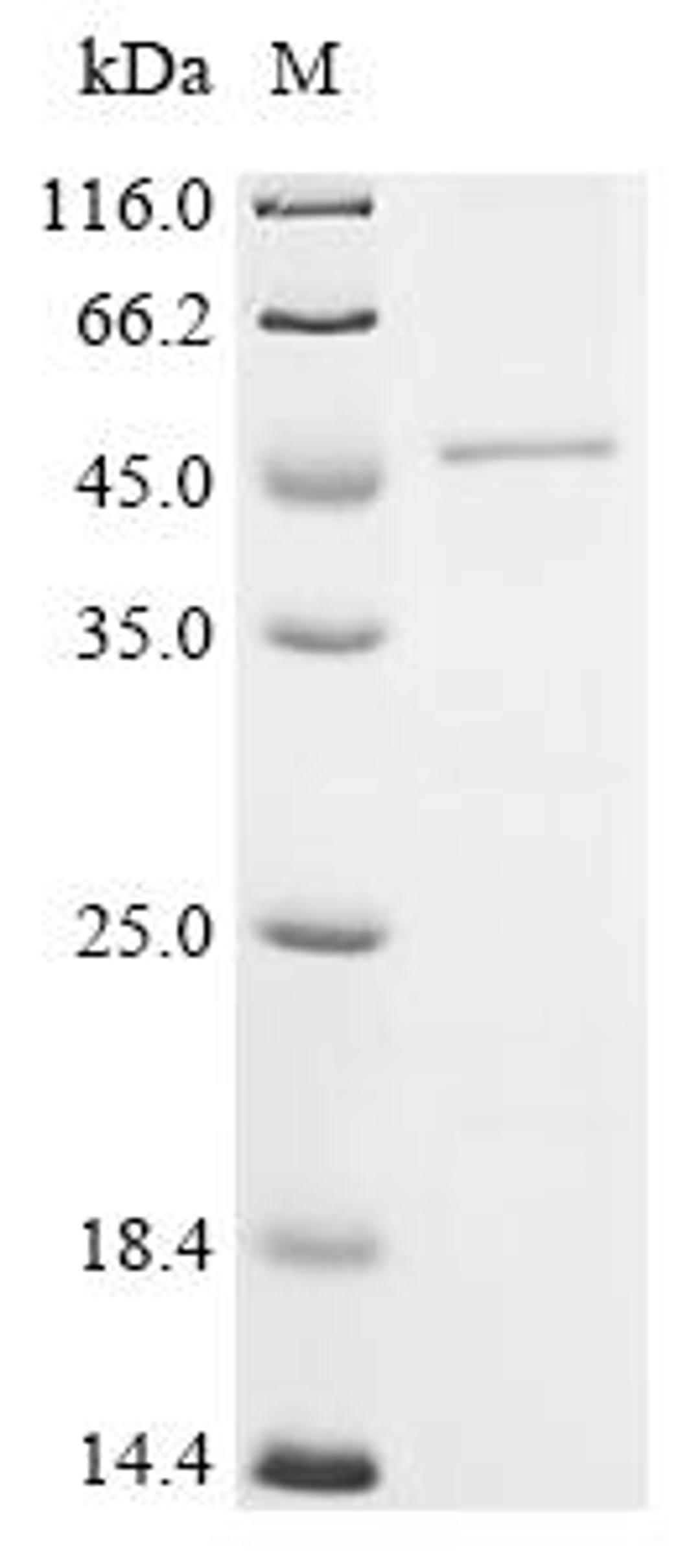(Tris-Glycine gel) Discontinuous SDS-PAGE (reduced) with 5% enrichment gel and 15% separation gel.