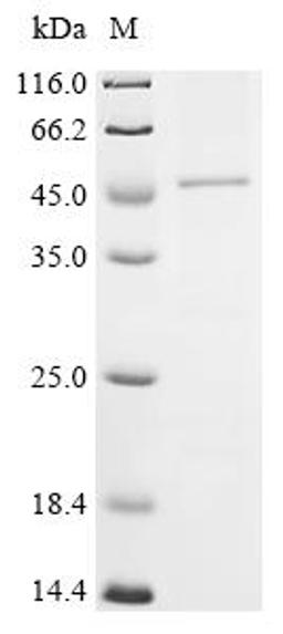 (Tris-Glycine gel) Discontinuous SDS-PAGE (reduced) with 5% enrichment gel and 15% separation gel.