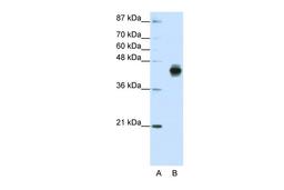 Antibody used in WB on Human HepG2 at 1.25 ug/ml.