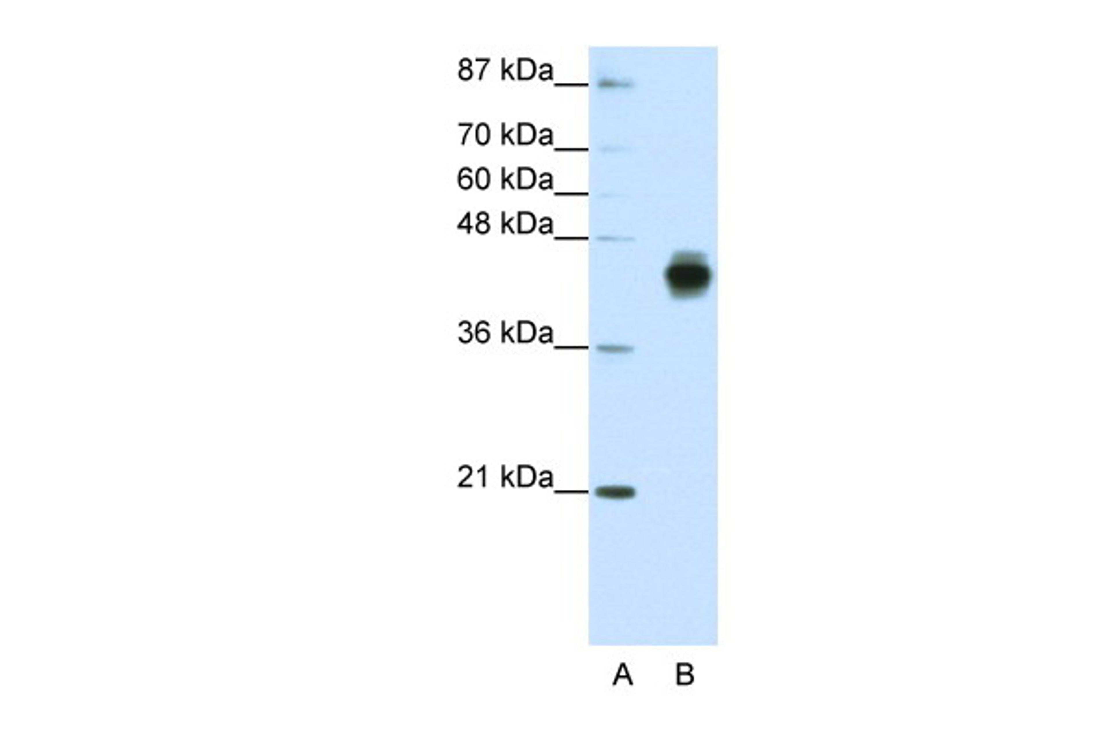 Antibody used in WB on Human HepG2 at 1.25 ug/ml.