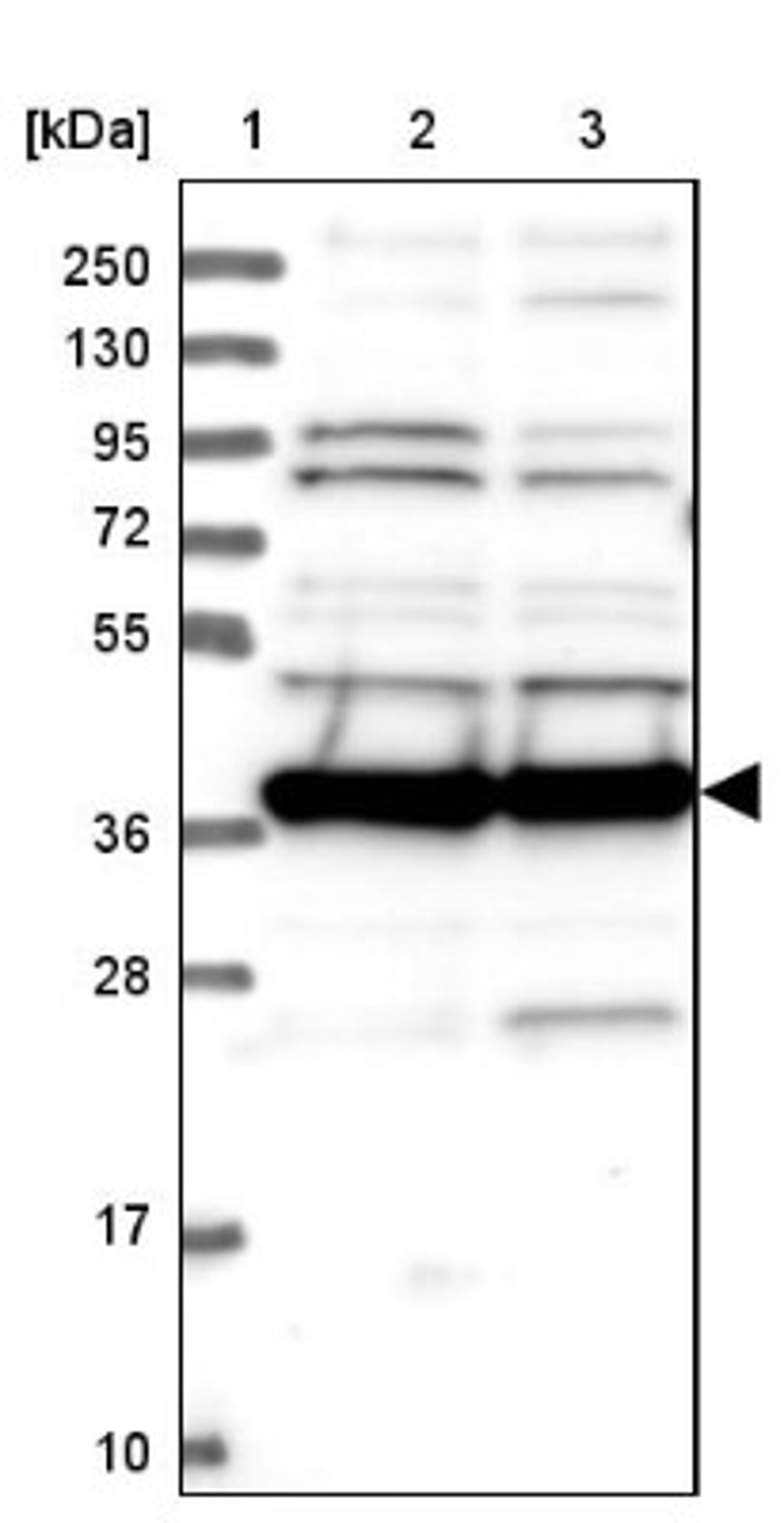 Western Blot: MRPS35 Antibody [NBP1-82786] - Lane 1: Marker [kDa] 250, 130, 95, 72, 55, 36, 28, 17, 10<br/>Lane 2: Human cell line RT-4<br/>Lane 3: Human cell line U-251MG sp