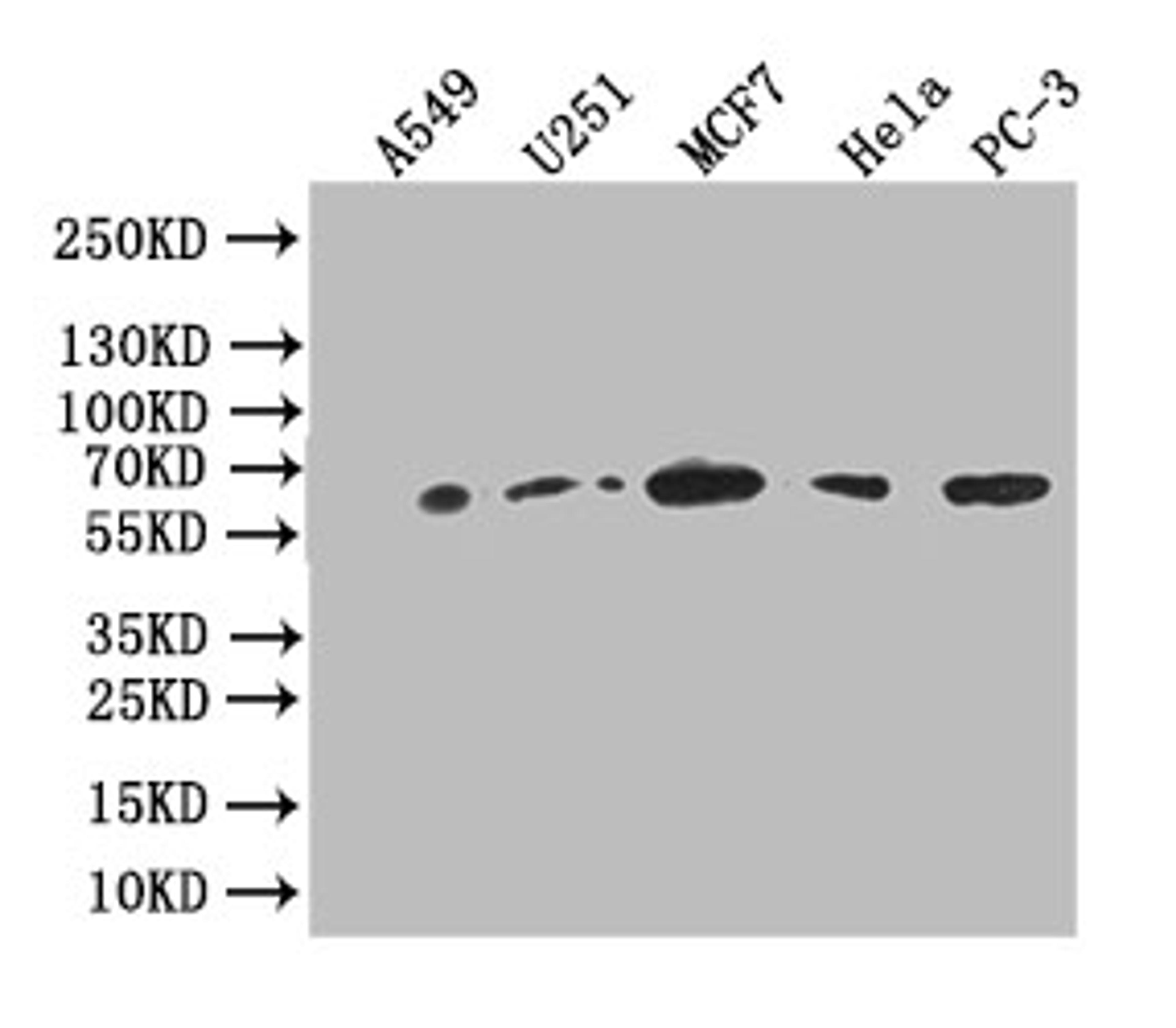 Western Blot. Positive WB detected in: A549 whole cell lysate, U251 whole cell lysate,MCF7 whole cell lysate,HELA whole cell lysate,PC-3 whole cell lysate. All lanes: Glucose 6 phosphate isomerase antibody at 1:1000. Secondary. Goat polyclonal to rabbit IgG at 1/50000 dilution. Predicted band size: 63 kDa. Observed band size: 63 kDa. 