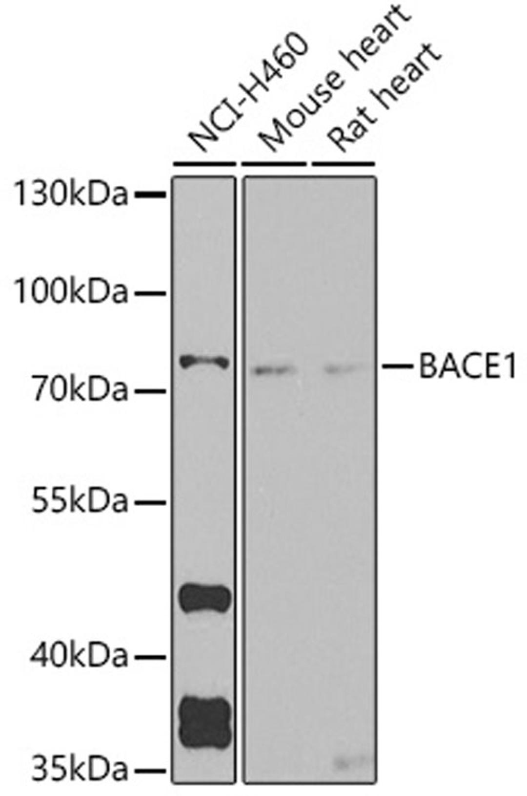 Western blot - BACE1 antibody (A5266)