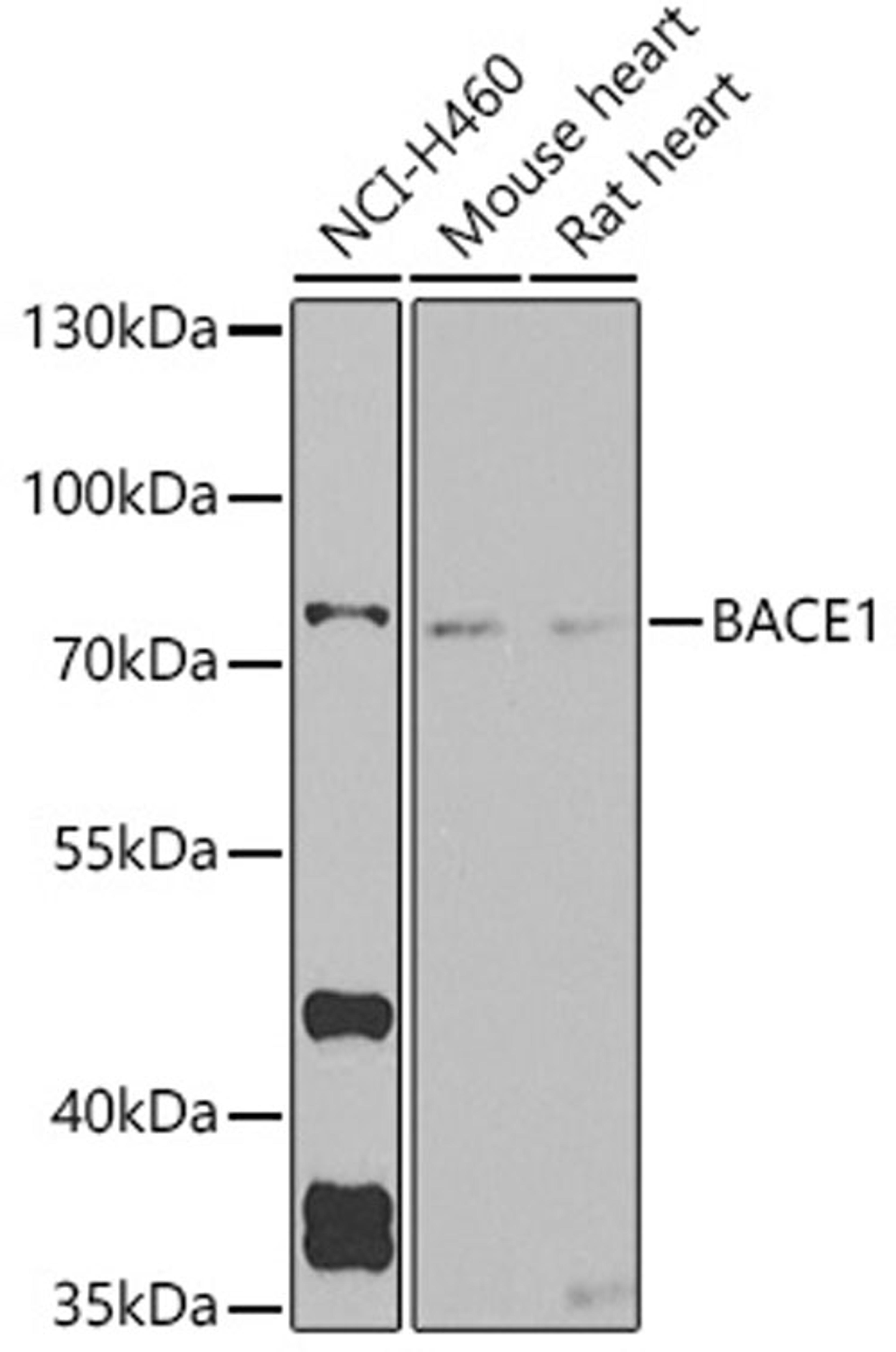 Western blot - BACE1 antibody (A5266)