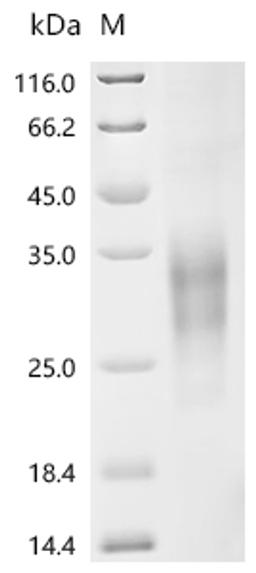 (Tris-Glycine gel) Discontinuous SDS-PAGE (reduced) with 5% enrichment gel and 15% separation gel.