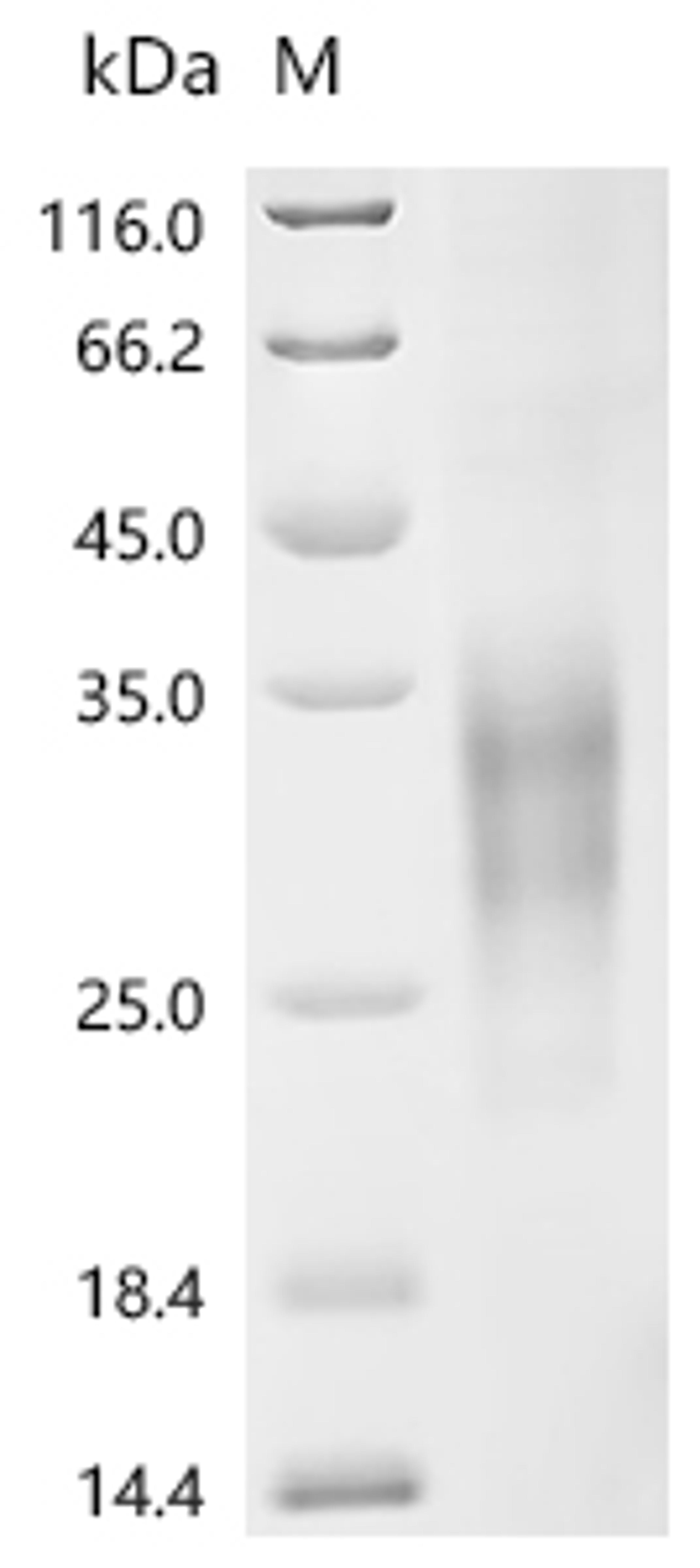 (Tris-Glycine gel) Discontinuous SDS-PAGE (reduced) with 5% enrichment gel and 15% separation gel.