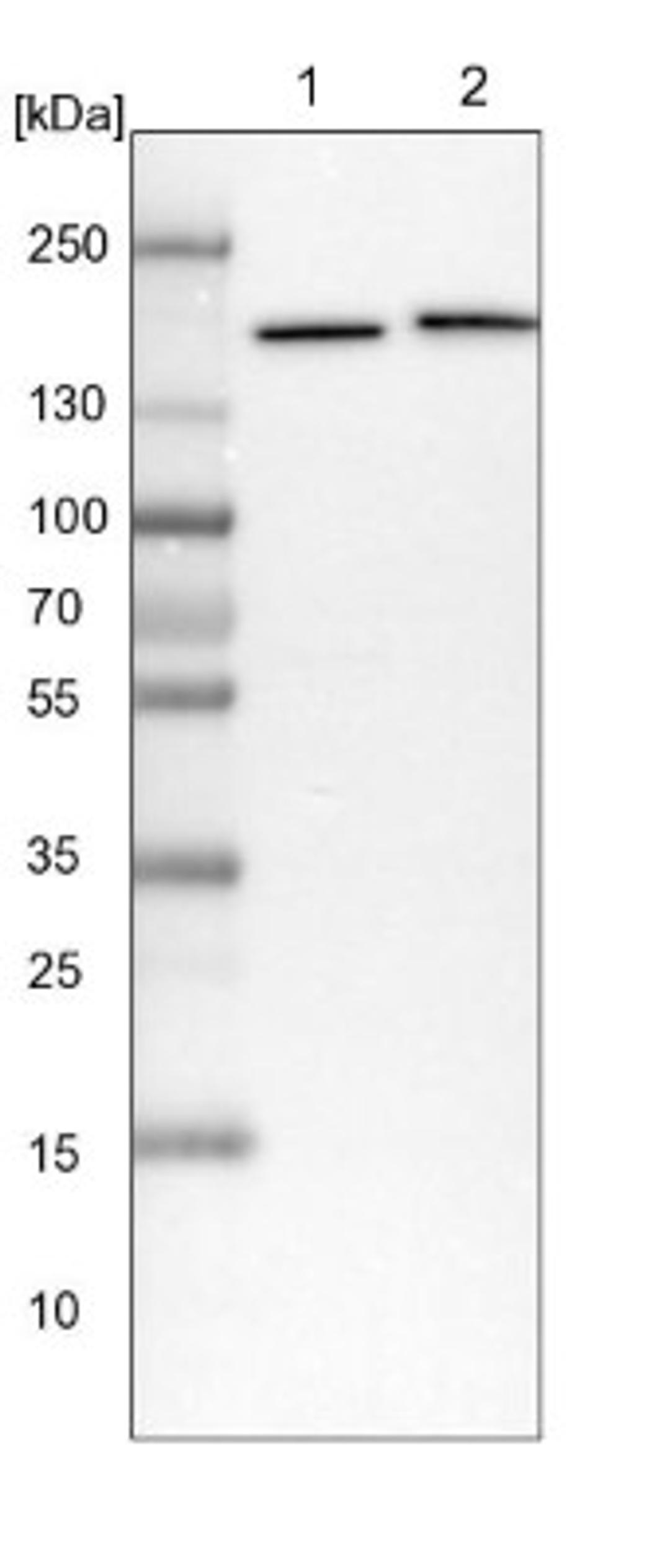 Western Blot: SMC4 Antibody [NBP1-86635] - Lane 1: NIH-3T3 cell lysate (Mouse embryonic fibroblast cells)<br/>Lane 2: NBT-II cell lysate (Rat Wistar bladder tumour cells)