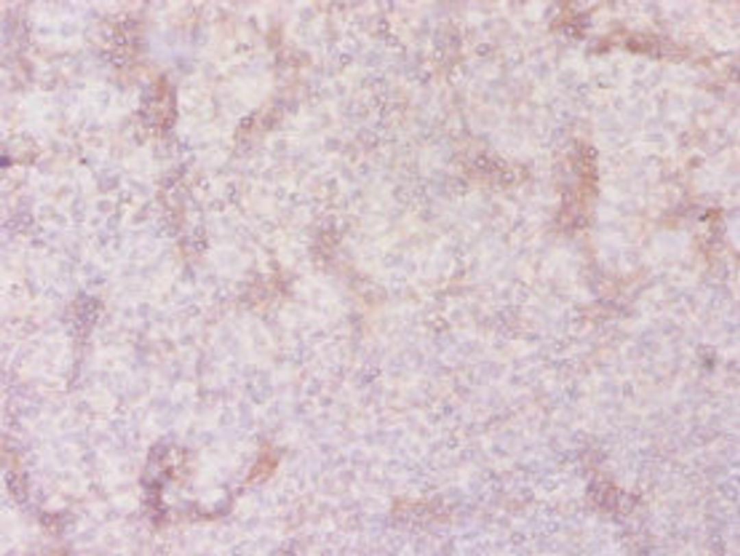Immunohistochemistry of paraffin-embedded human tonsil tissue using CSB-PA021643LA01HU at dilution of 1:20