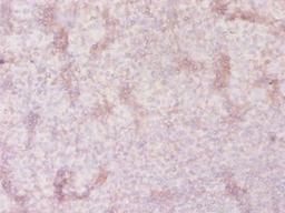 Immunohistochemistry of paraffin-embedded human tonsil tissue using CSB-PA021643LA01HU at dilution of 1:20
