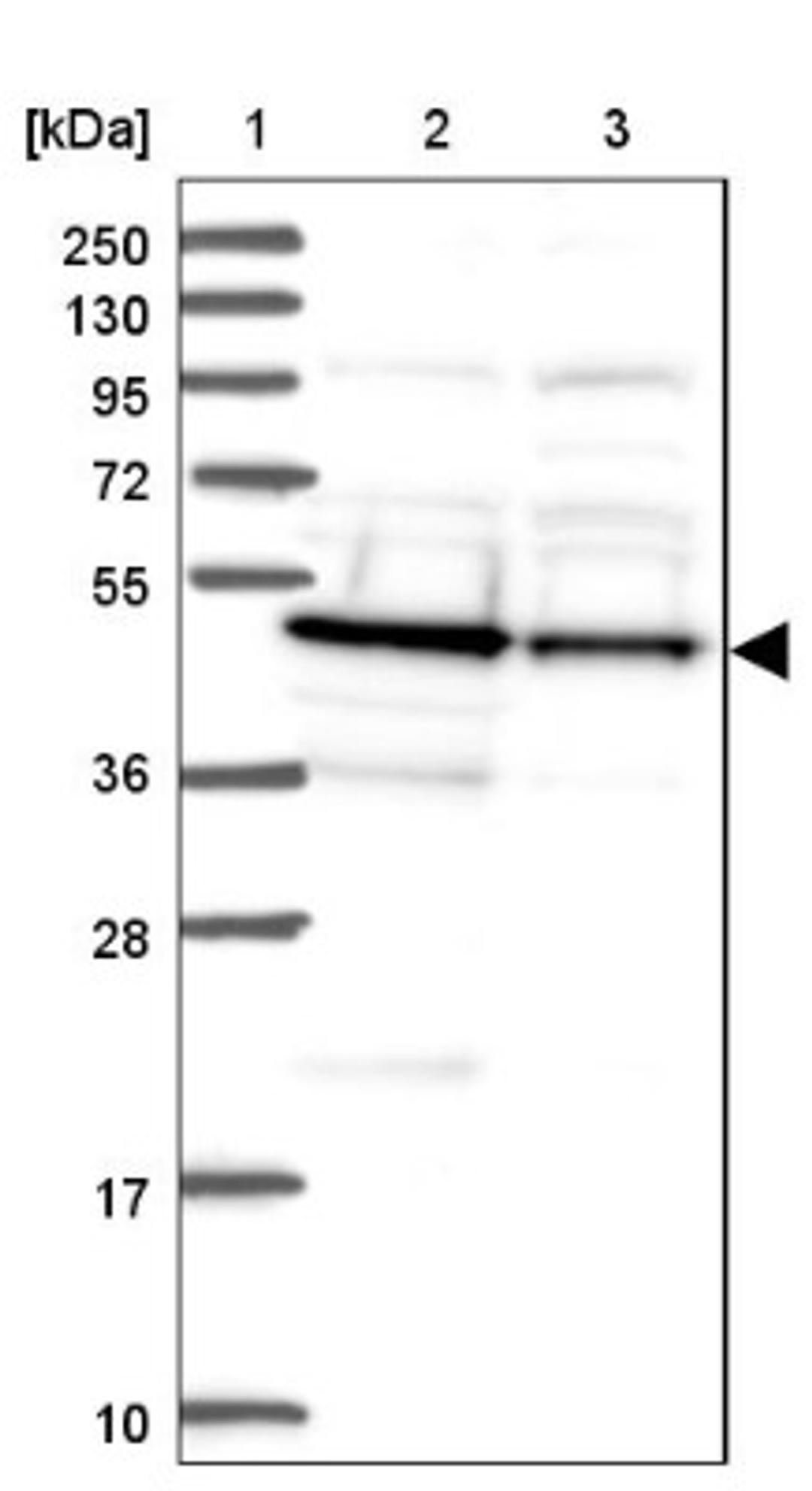 Western Blot: DDI2 Antibody [NBP2-47493] - Lane 1: Marker [kDa] 250, 130, 95, 72, 55, 36, 28, 17, 10.  Lane 2: Human cell line RT-4.  Lane 3: Human cell line U-251MG.