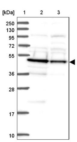 Western Blot: DDI2 Antibody [NBP2-47493] - Lane 1: Marker [kDa] 250, 130, 95, 72, 55, 36, 28, 17, 10.  Lane 2: Human cell line RT-4.  Lane 3: Human cell line U-251MG.