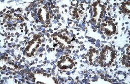 Antibody used in IHC on Human Lung.