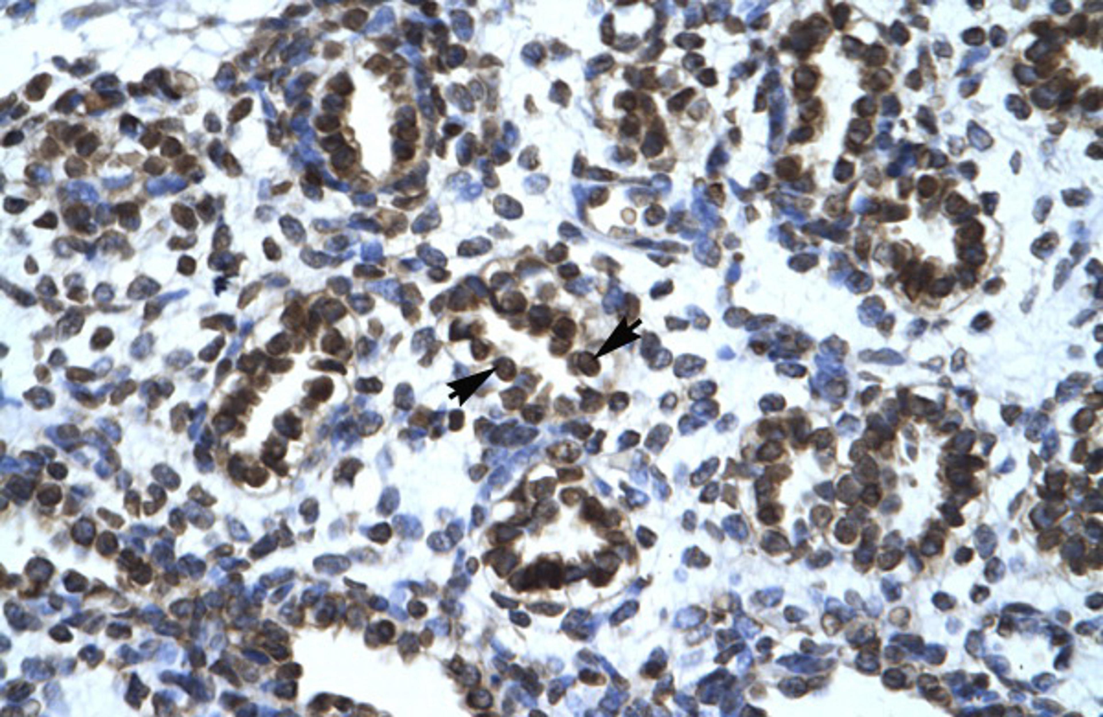 Antibody used in IHC on Human Lung.