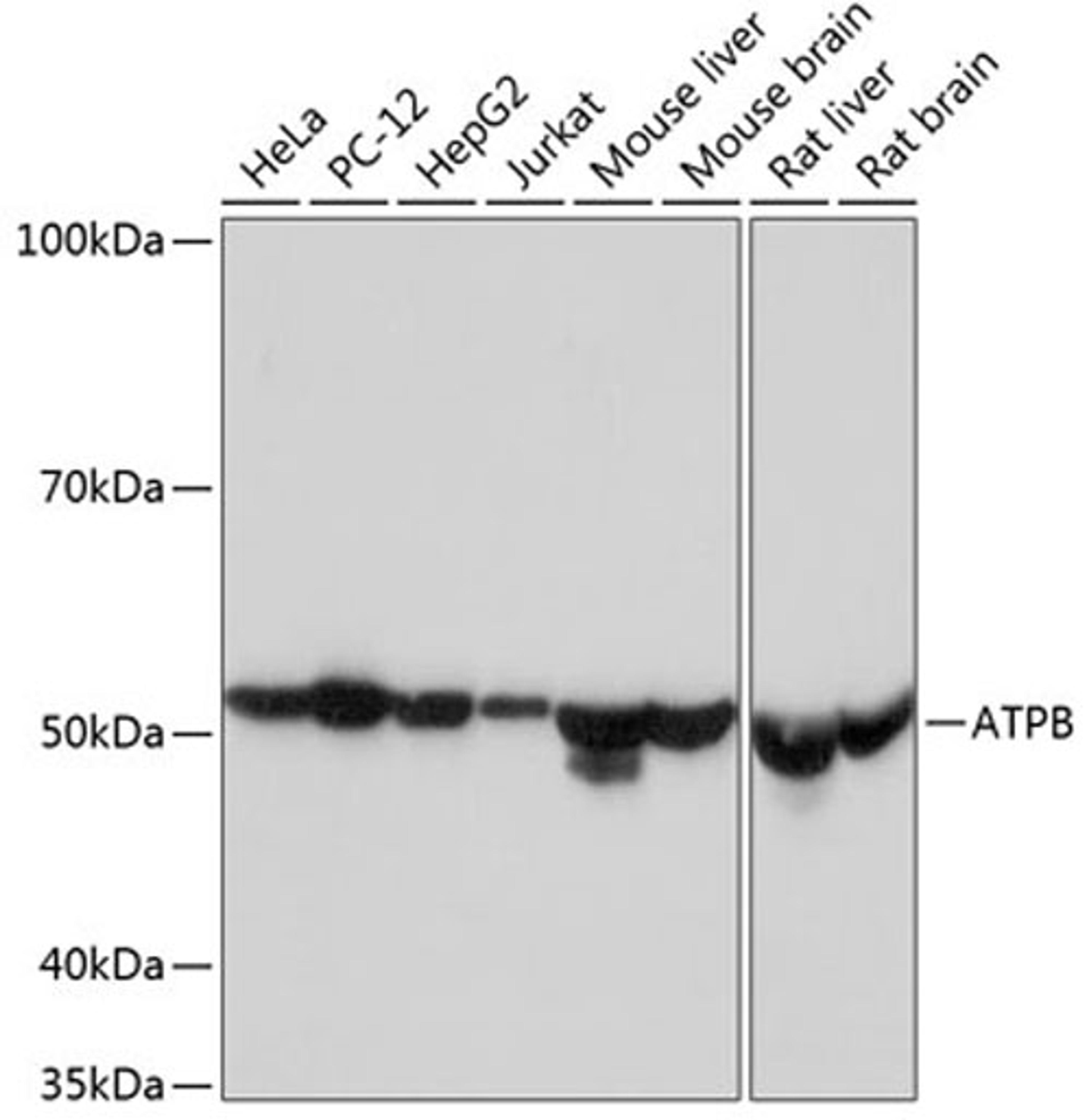 Western blot - ATPB Rabbit mAb (A11214)