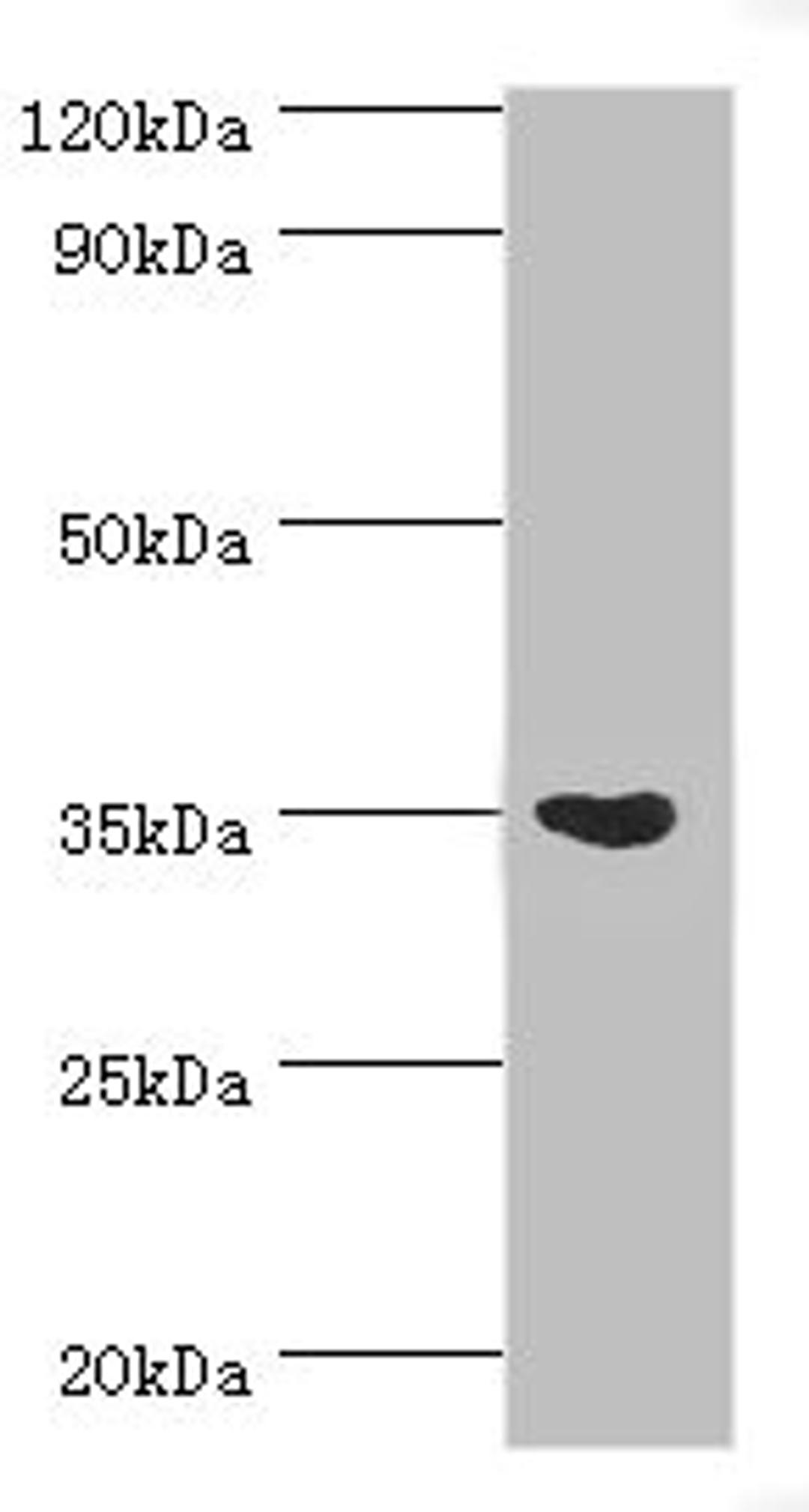Western blot. All lanes: Arginase-1 antibody at 3ug/ml + Mouse liver tissue. Secondary. Goat polyclonal to rabbit IgG at 1/10000 dilution. Predicted band size: 35, 36, 26 kDa. Observed band size: 35 kDa.