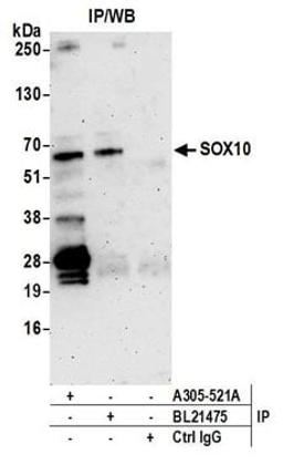 Detection of human SOX10 by western blot of immunoprecipitates.