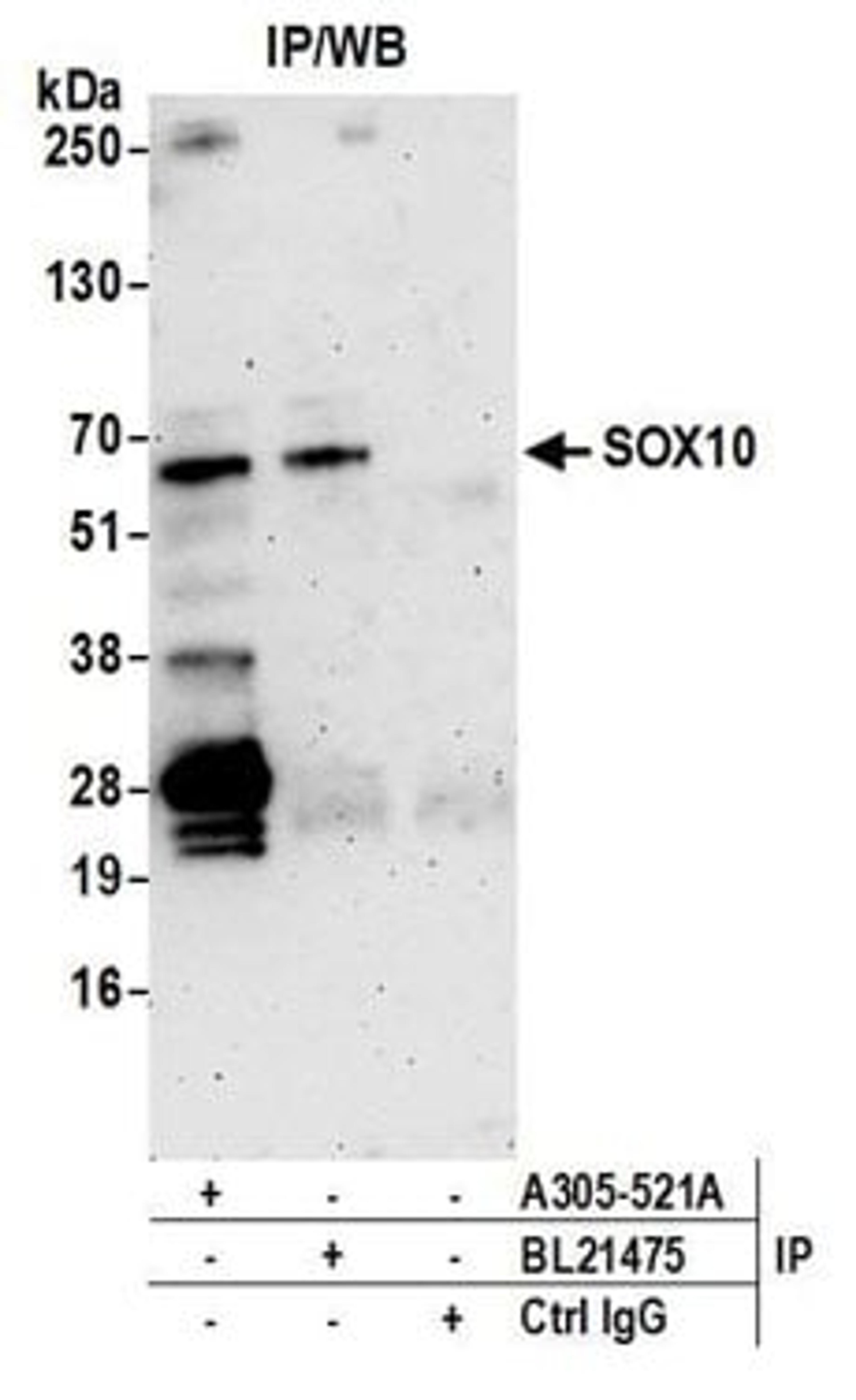 Detection of human SOX10 by western blot of immunoprecipitates.