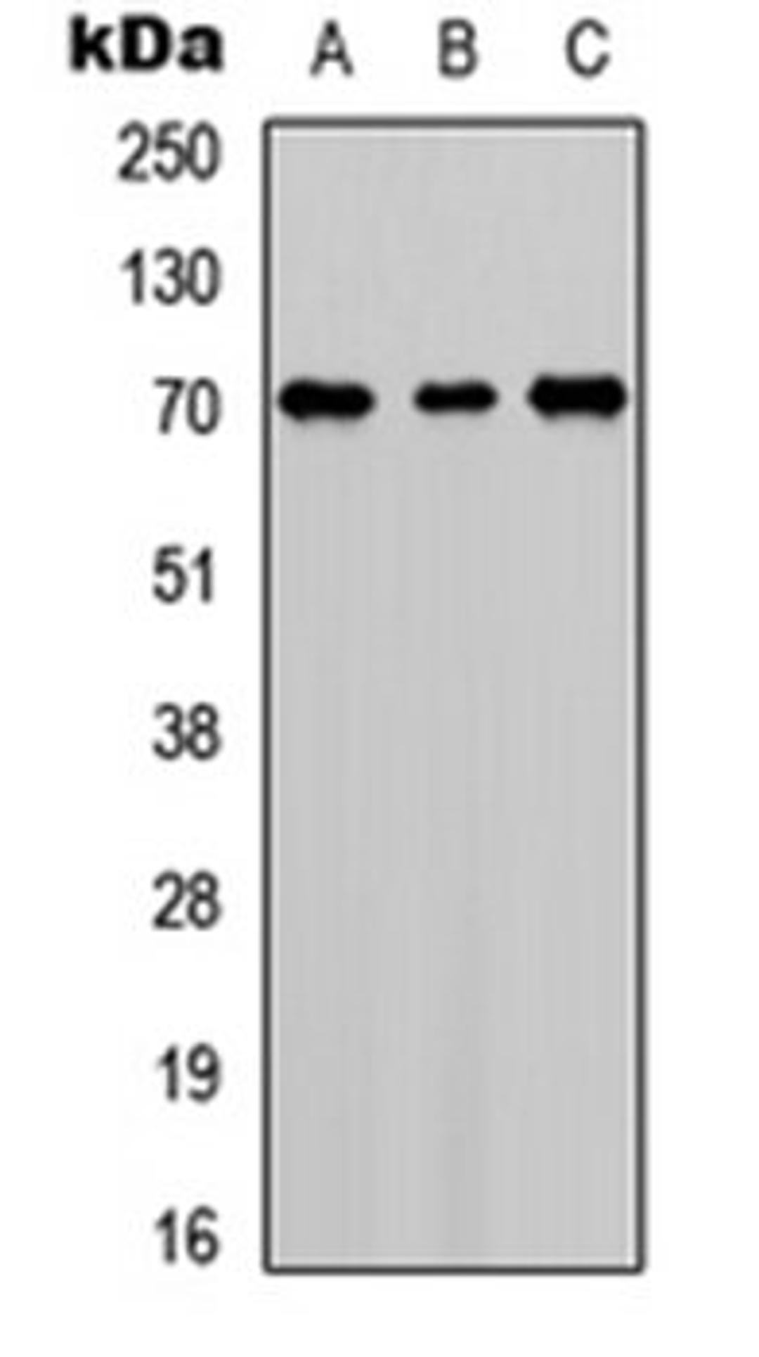 Western blot analysis of HEK293T (Lane 1), NS-1 (Lane 2), PC12 (Lane 3) whole cell lysates using Factor XI LC antibody