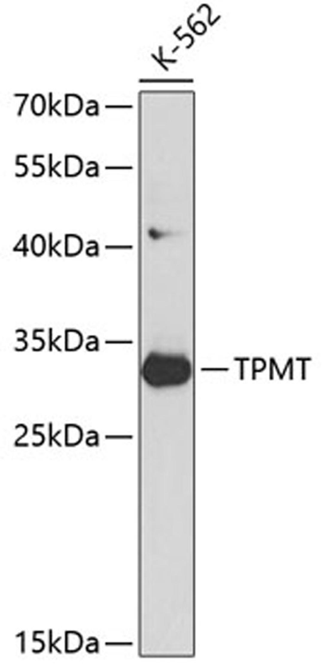 Western blot - TPMT antibody (A1017)