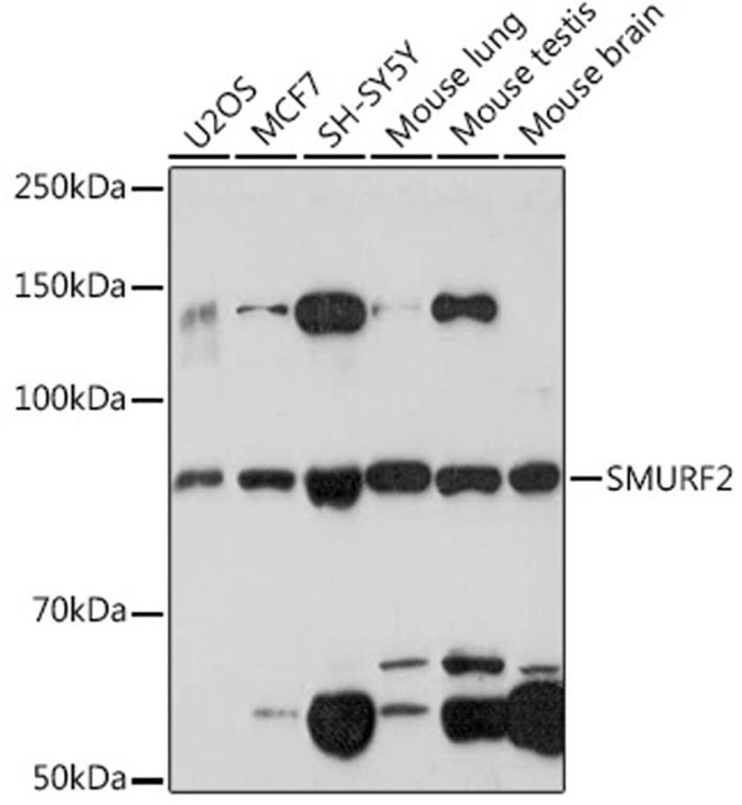 Western blot - SMURF2 Rabbit mAb (A2278)