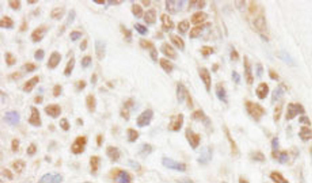 Detection of human JMJD1C by immunohistochemistry.