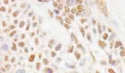 Detection of human JMJD1C by immunohistochemistry.