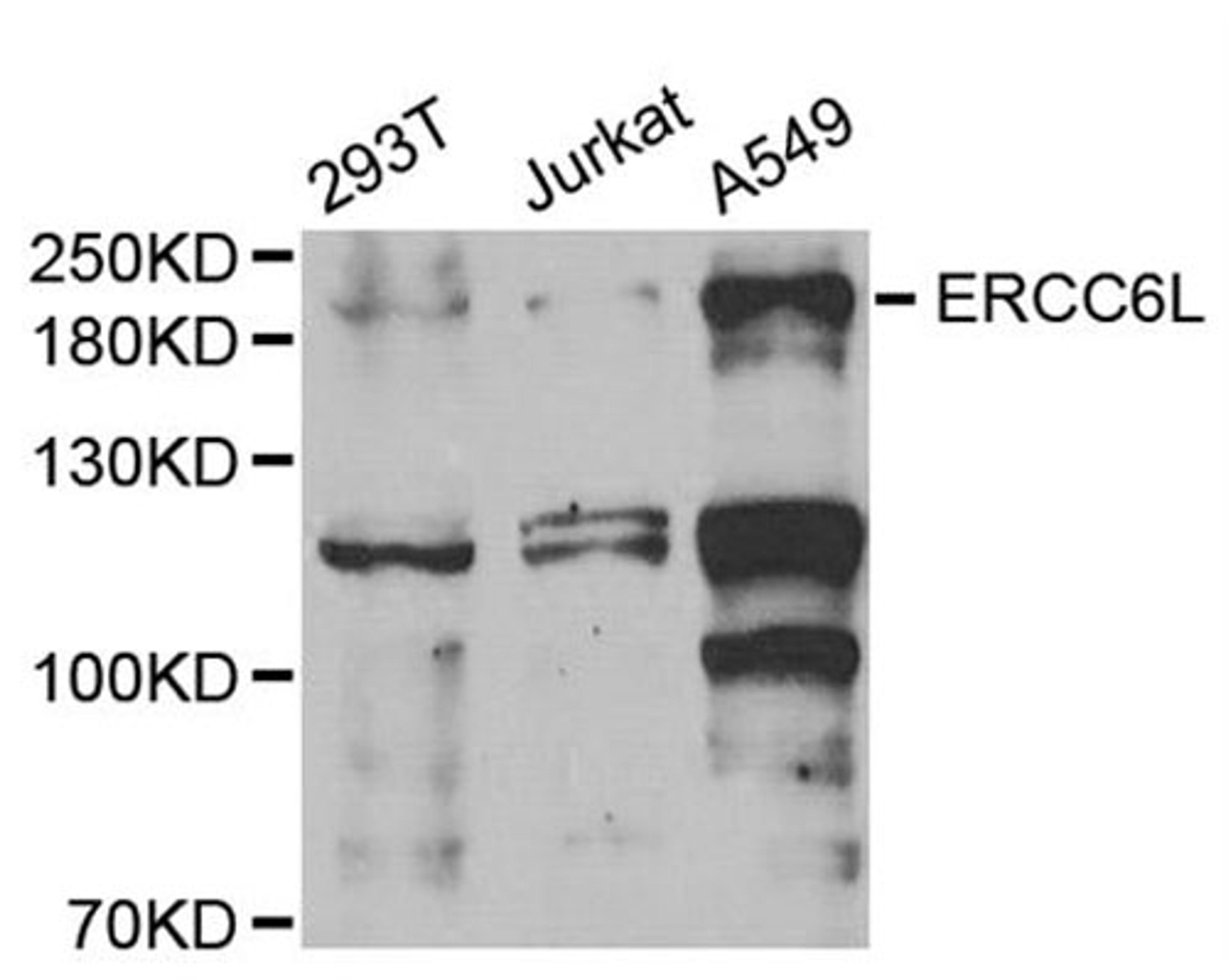 Western blot - ERCC6L antibody (A6139)