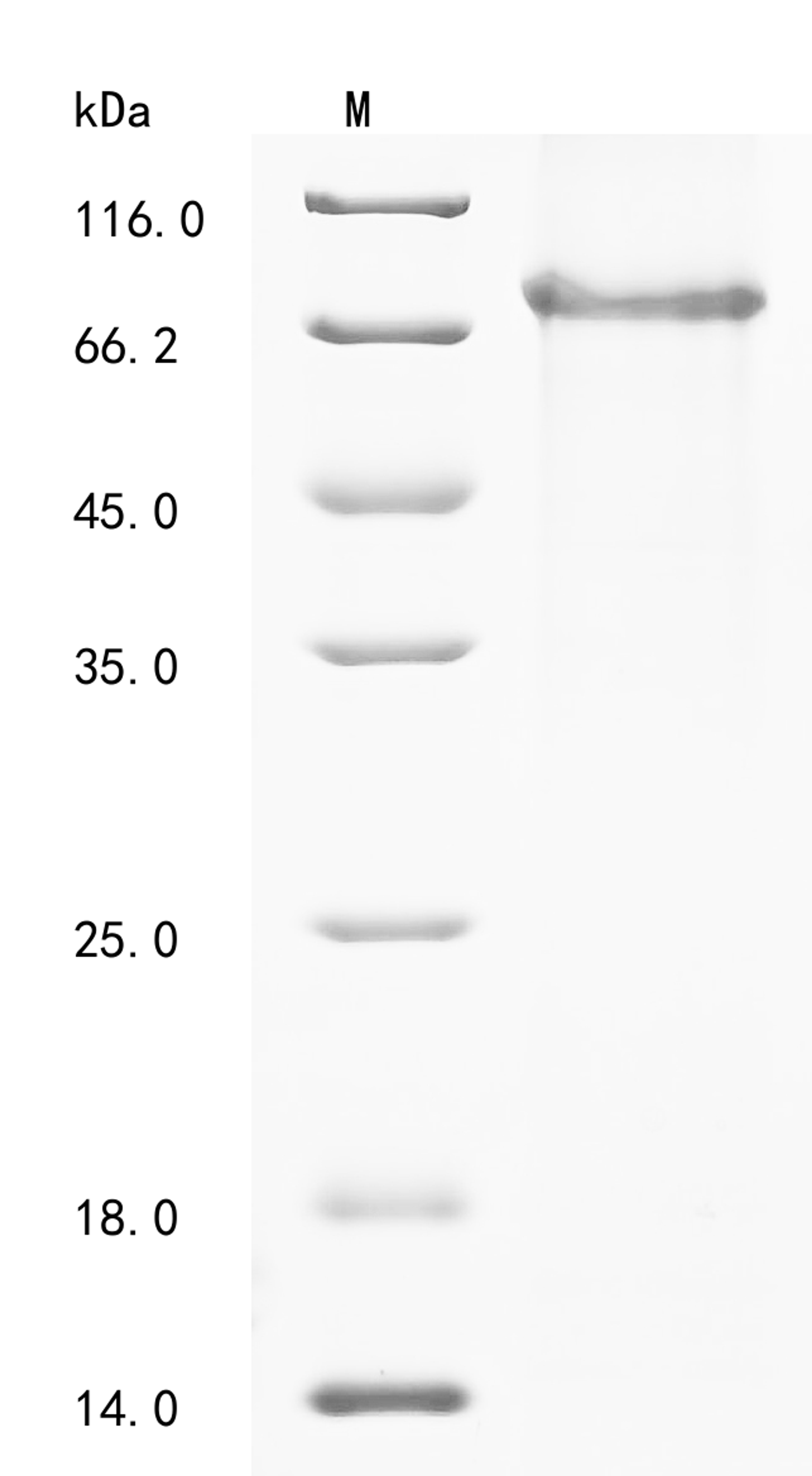 (Tris-Glycine gel) Discontinuous SDS-PAGE (reduced) with 5% enrichment gel and 15% separation gel.