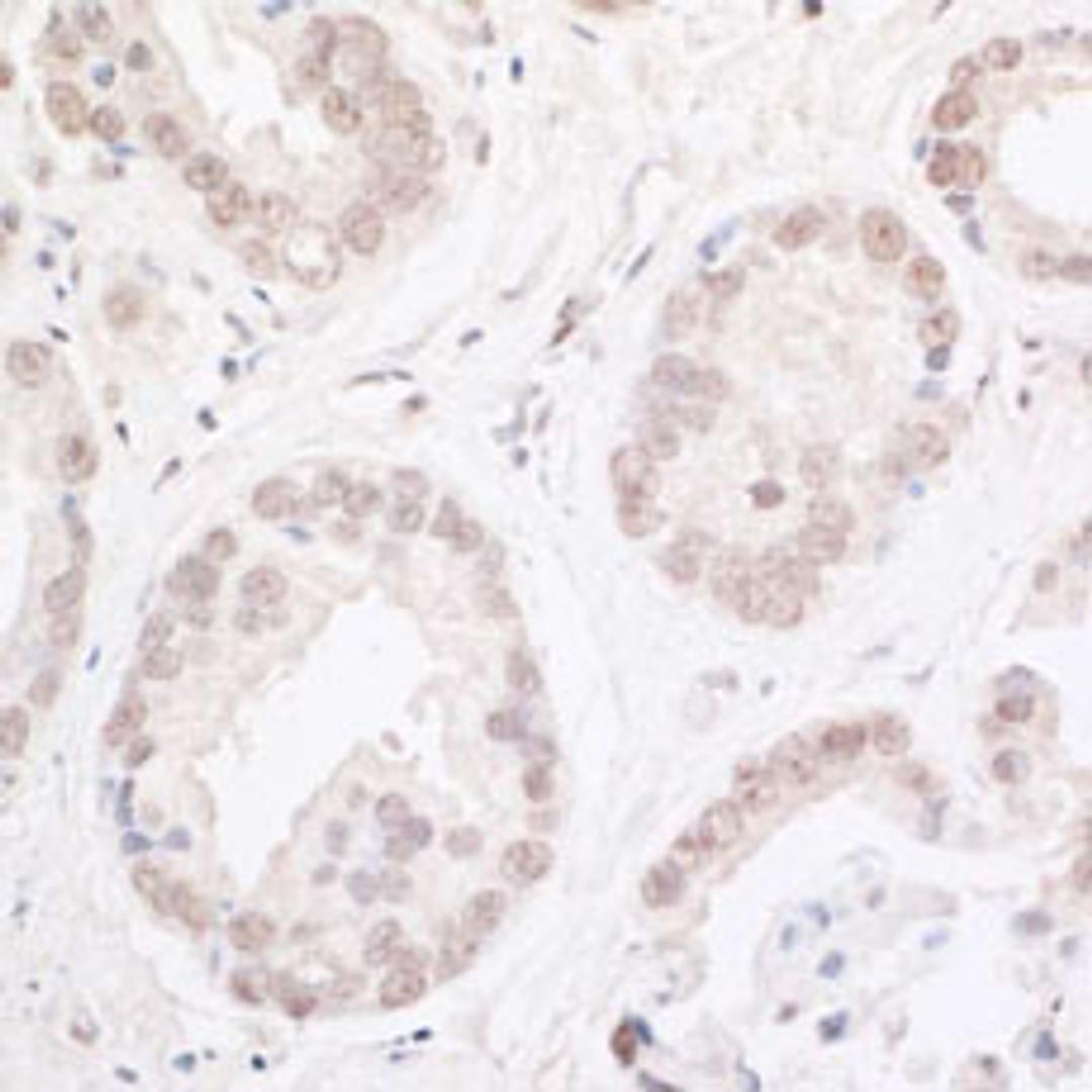 Detection of human ARID2 by immunohistochemistry.