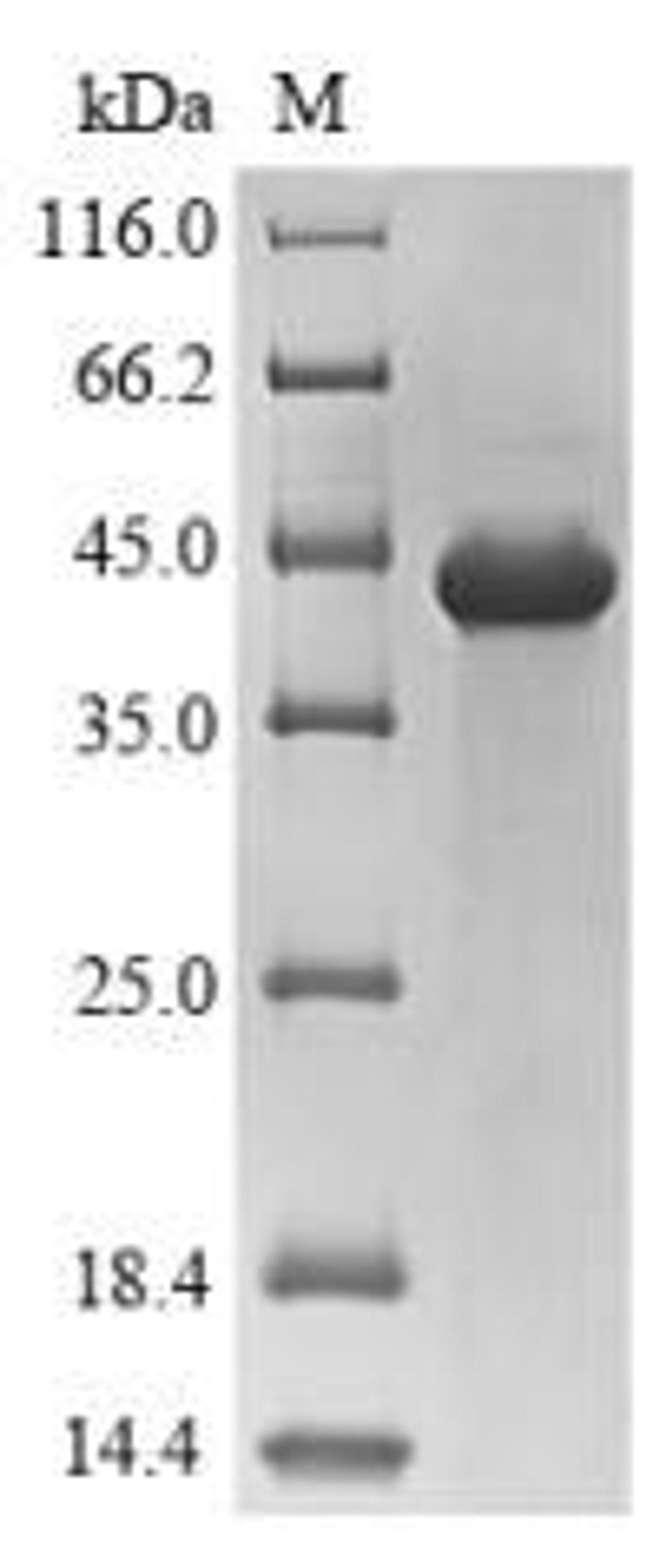 (Tris-Glycine gel) Discontinuous SDS-PAGE (reduced) with 5% enrichment gel and 15% separation gel.