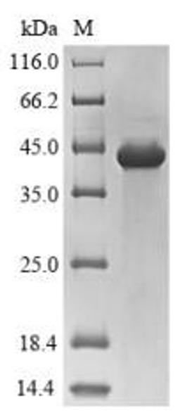 (Tris-Glycine gel) Discontinuous SDS-PAGE (reduced) with 5% enrichment gel and 15% separation gel.