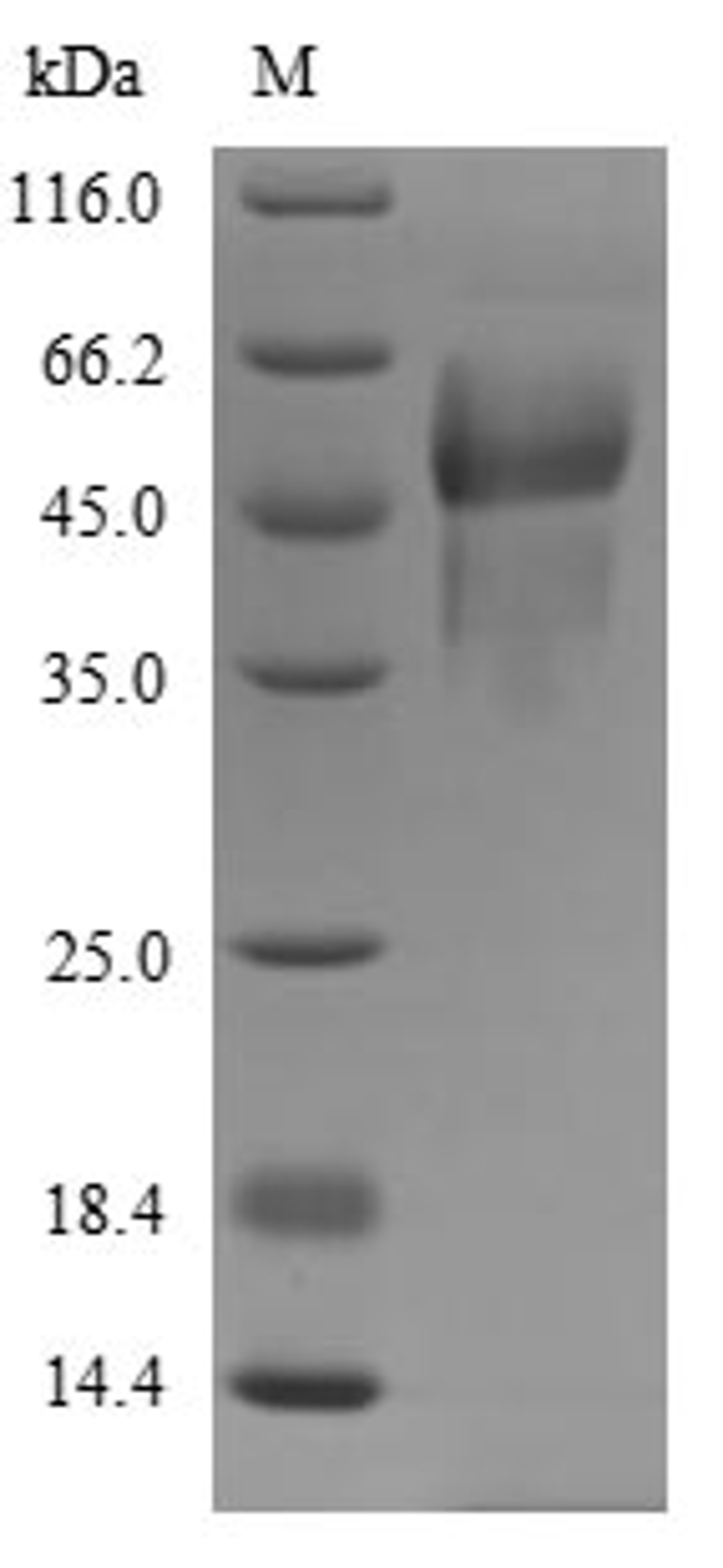 (Tris-Glycine gel) Discontinuous SDS-PAGE (reduced) with 5% enrichment gel and 15% separation gel.