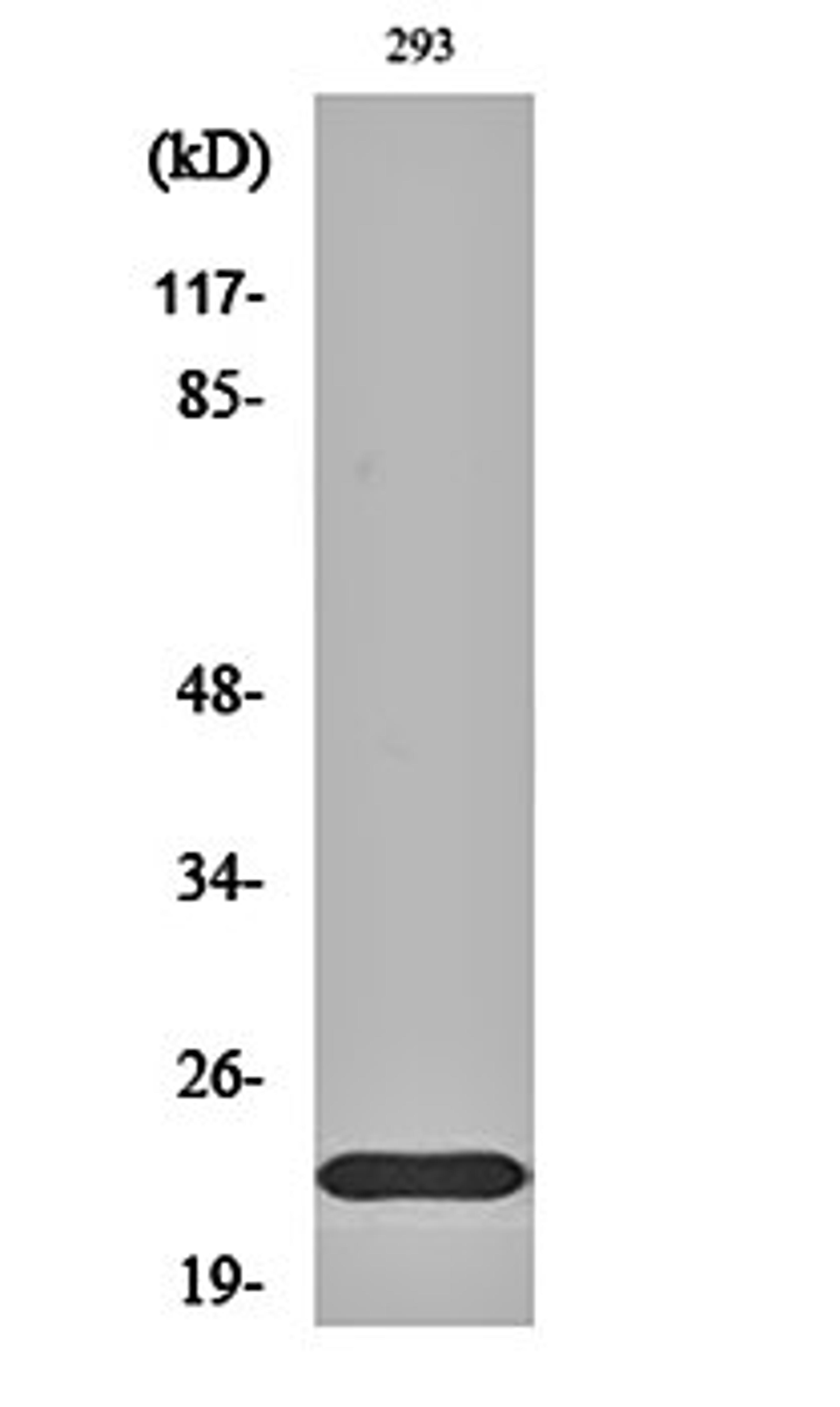 Western blot analysis of 293 cell lysates using Na+ CP type II beta antibody