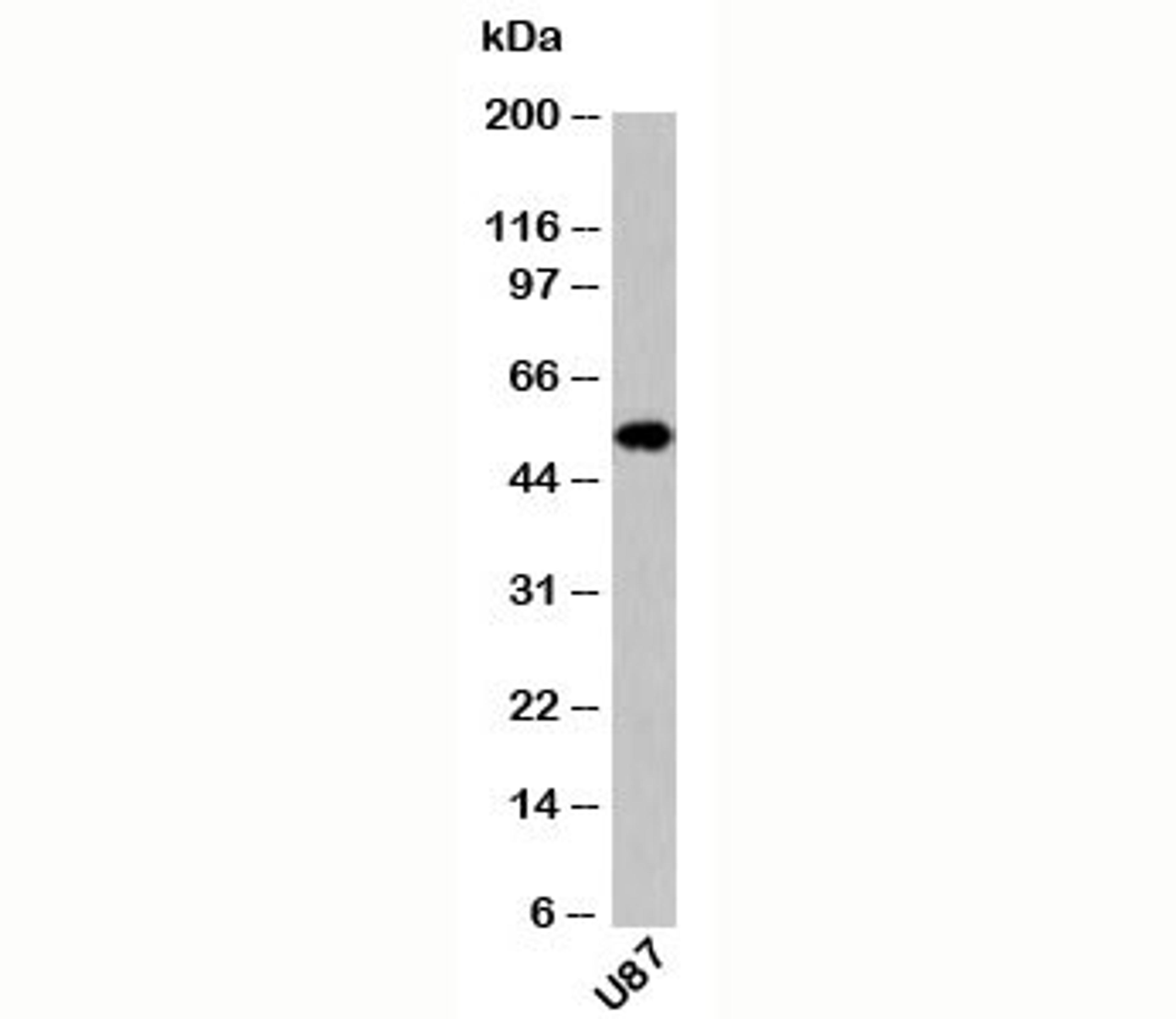 Western blot testing of human samples with Neurotensin Receptor 2 antibody at 0.5ug/ml.