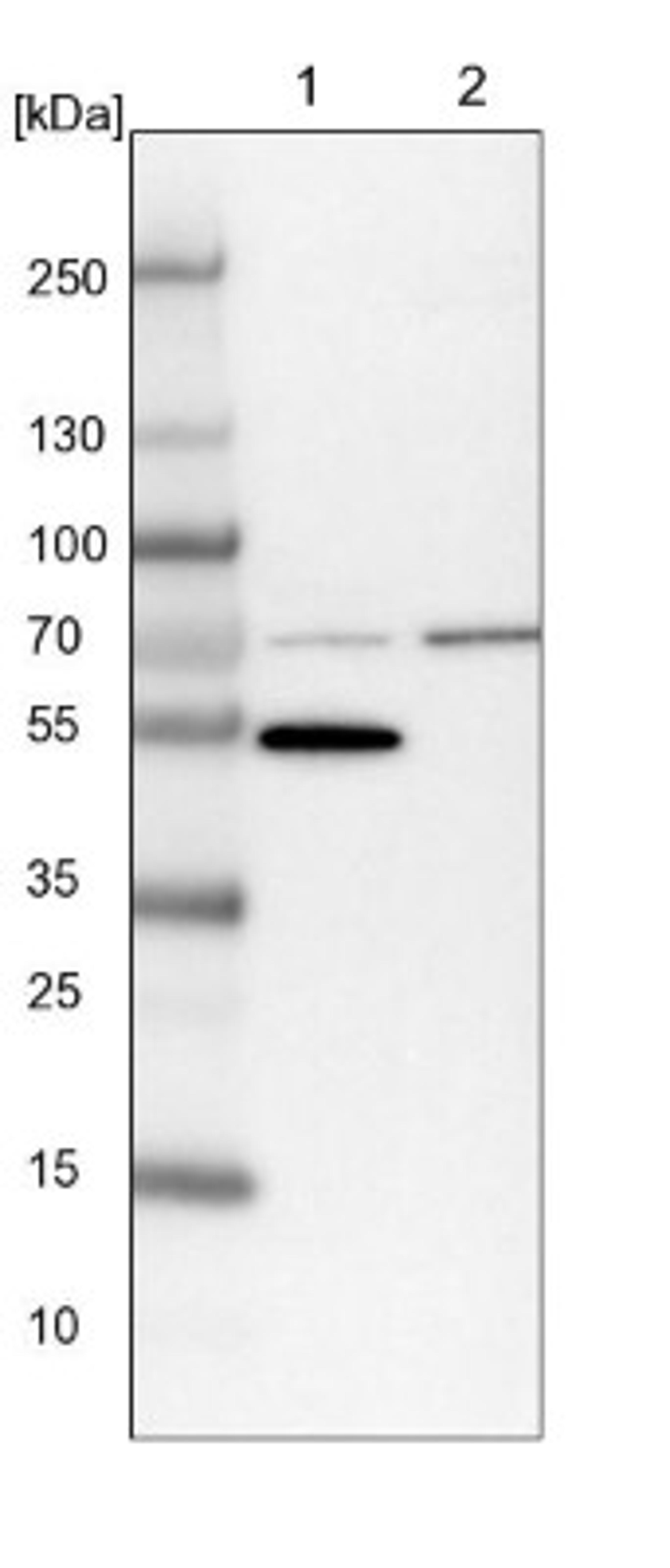 Western Blot: Beta Lactamase Antibody [NBP1-91701] - Lane 1: NIH-3T3 cell lysate (Mouse embryonic fibroblast cells)<br/>Lane 2: NBT-II cell lysate (Rat Wistar bladder tumour cells)