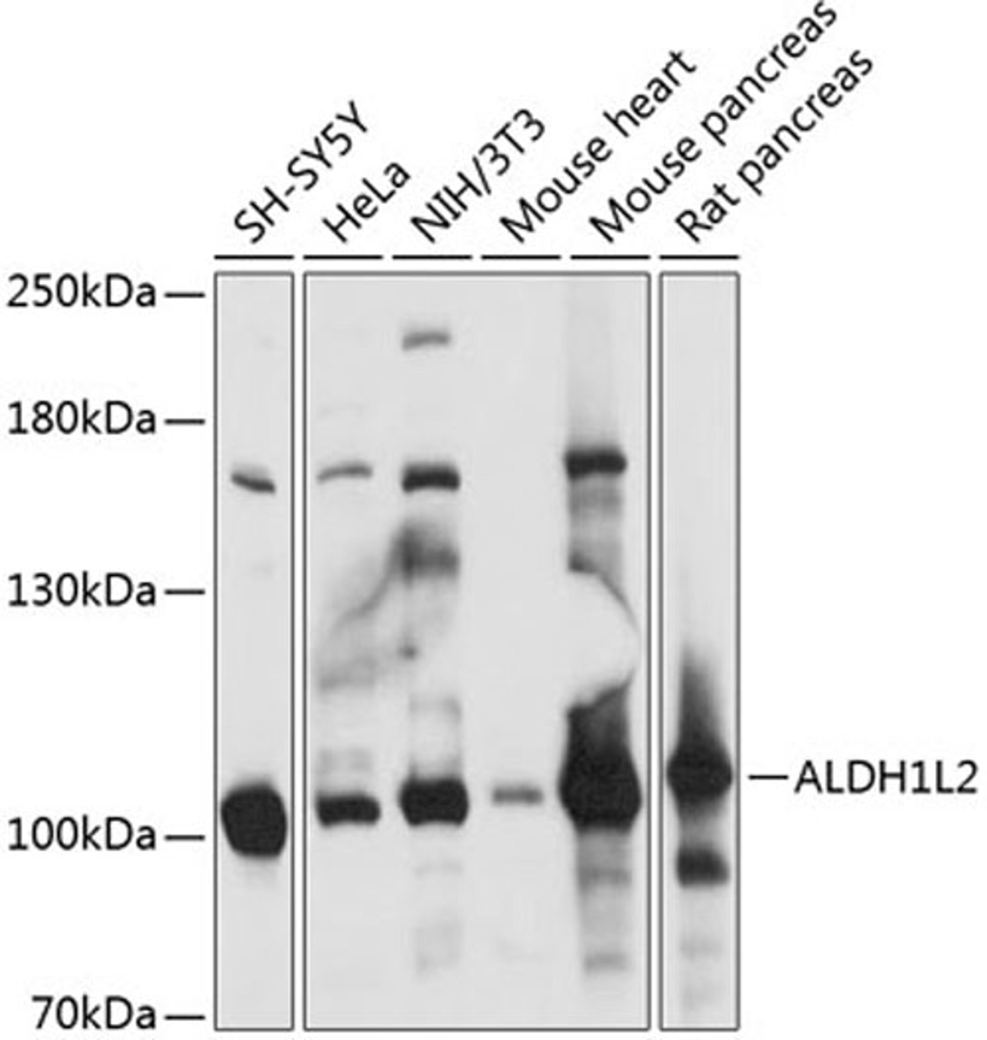 Western blot - ALDH1L2 antibody (A14455)