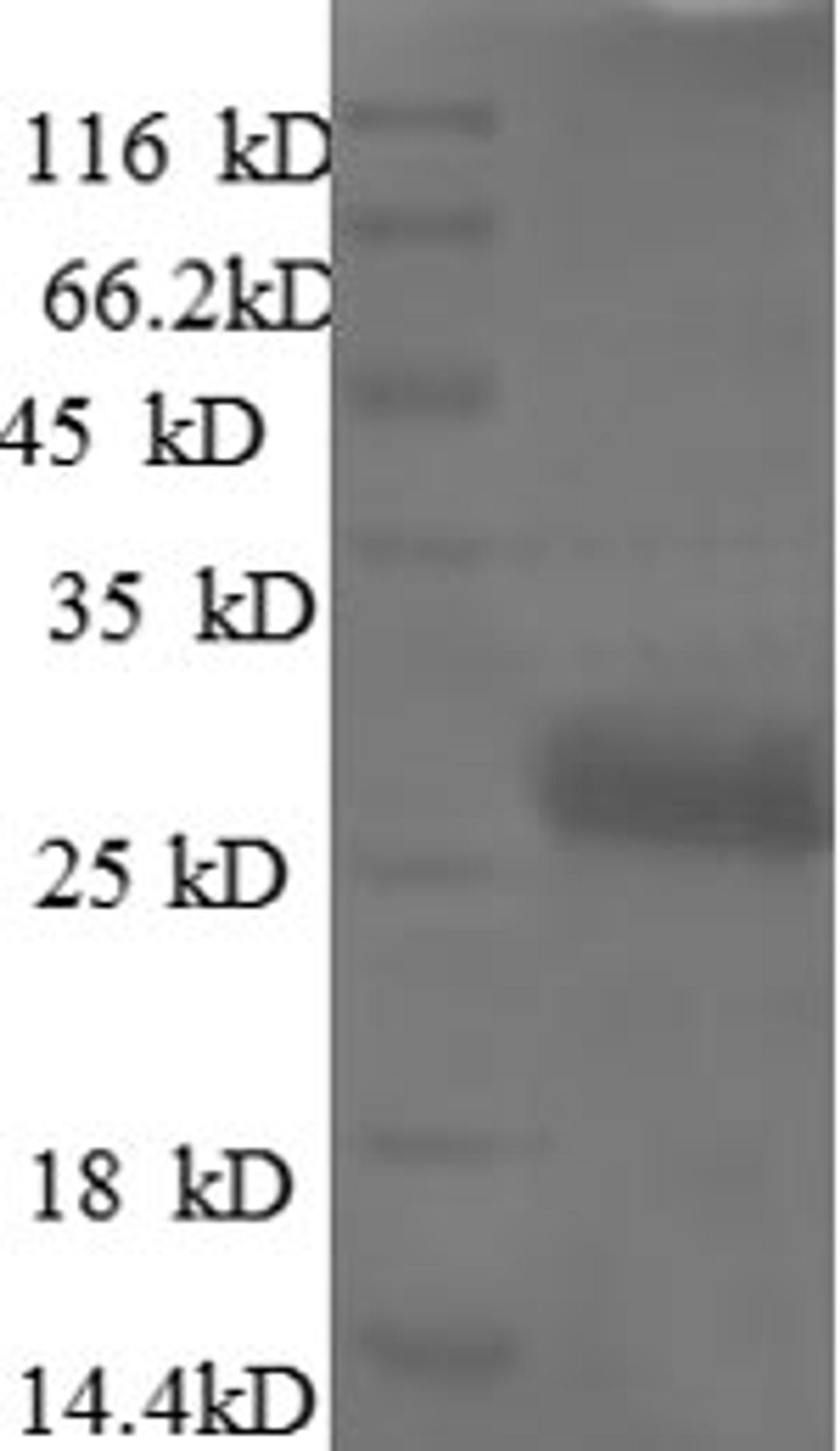 (Tris-Glycine gel) Discontinuous SDS-PAGE (reduced) with 5% enrichment gel and 15% separation gel.