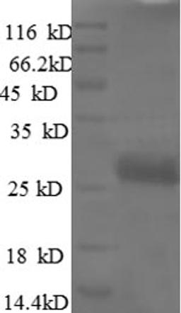 (Tris-Glycine gel) Discontinuous SDS-PAGE (reduced) with 5% enrichment gel and 15% separation gel.