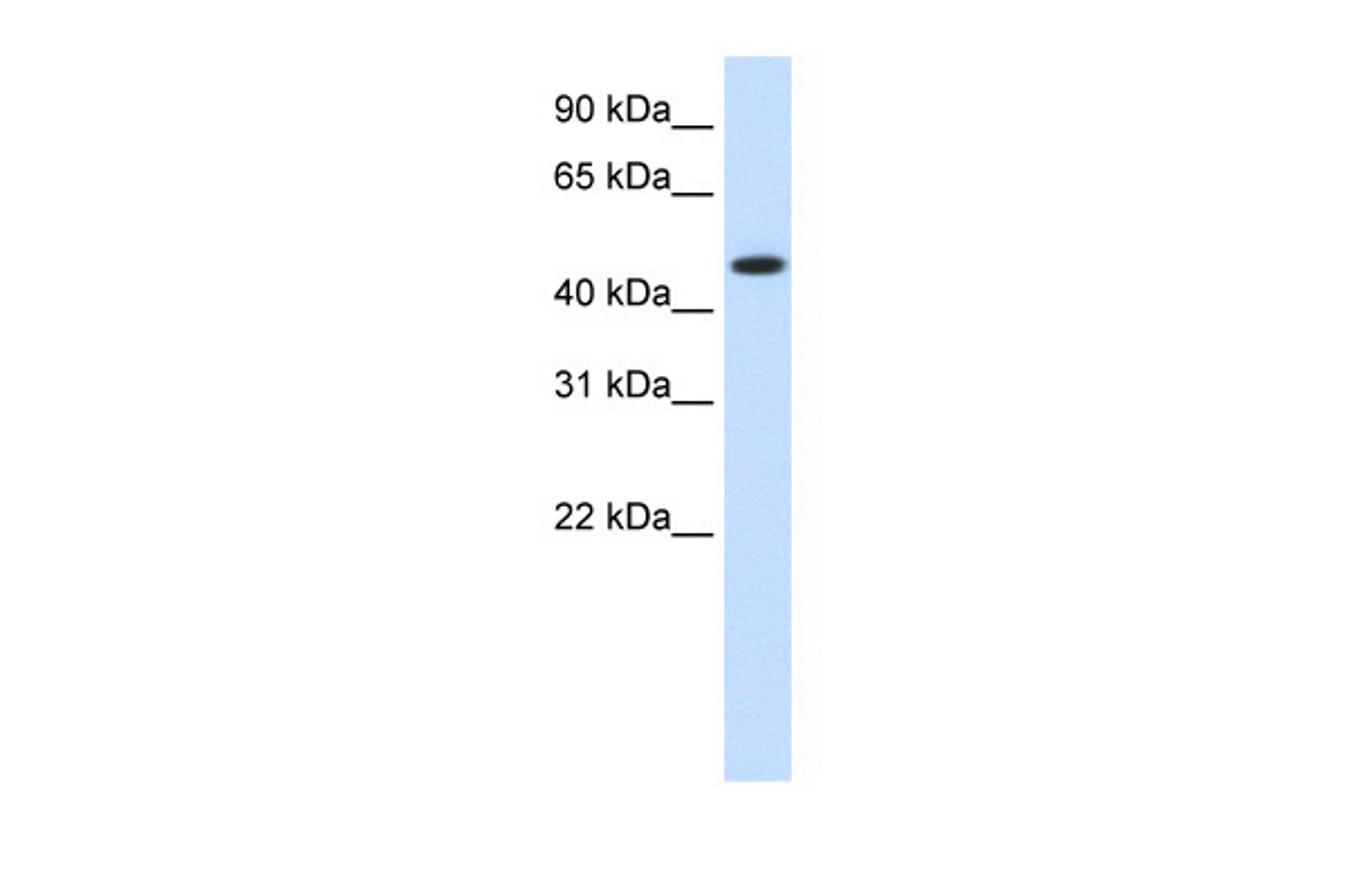 Antibody used in WB on Human Muscle at 1.25 ug/ml.