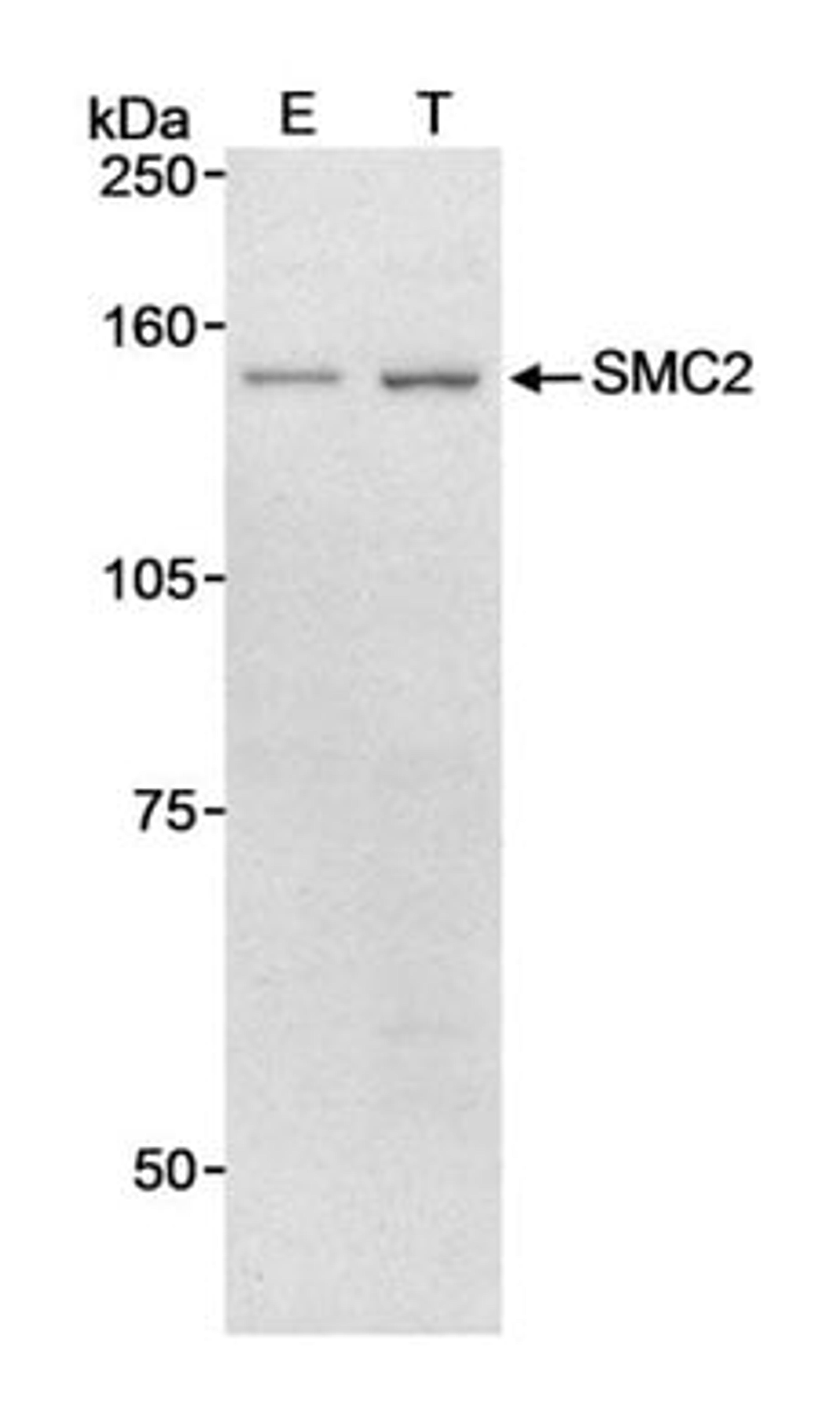 Detection of human SMC2 by western blot.