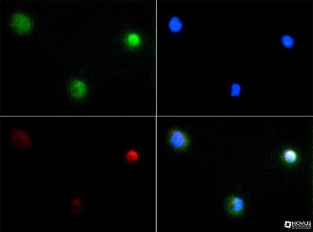 Immunocytochemistry/Immunofluorescence: PIEZO2 Antibody [NBP1-78538] - PIEZO2 antibody was tested at 1:100 in A431 cells with FITC (green). Nuclei and alpha-tubulin were counterstained with DAPI (blue) and Dylight 550 (red).