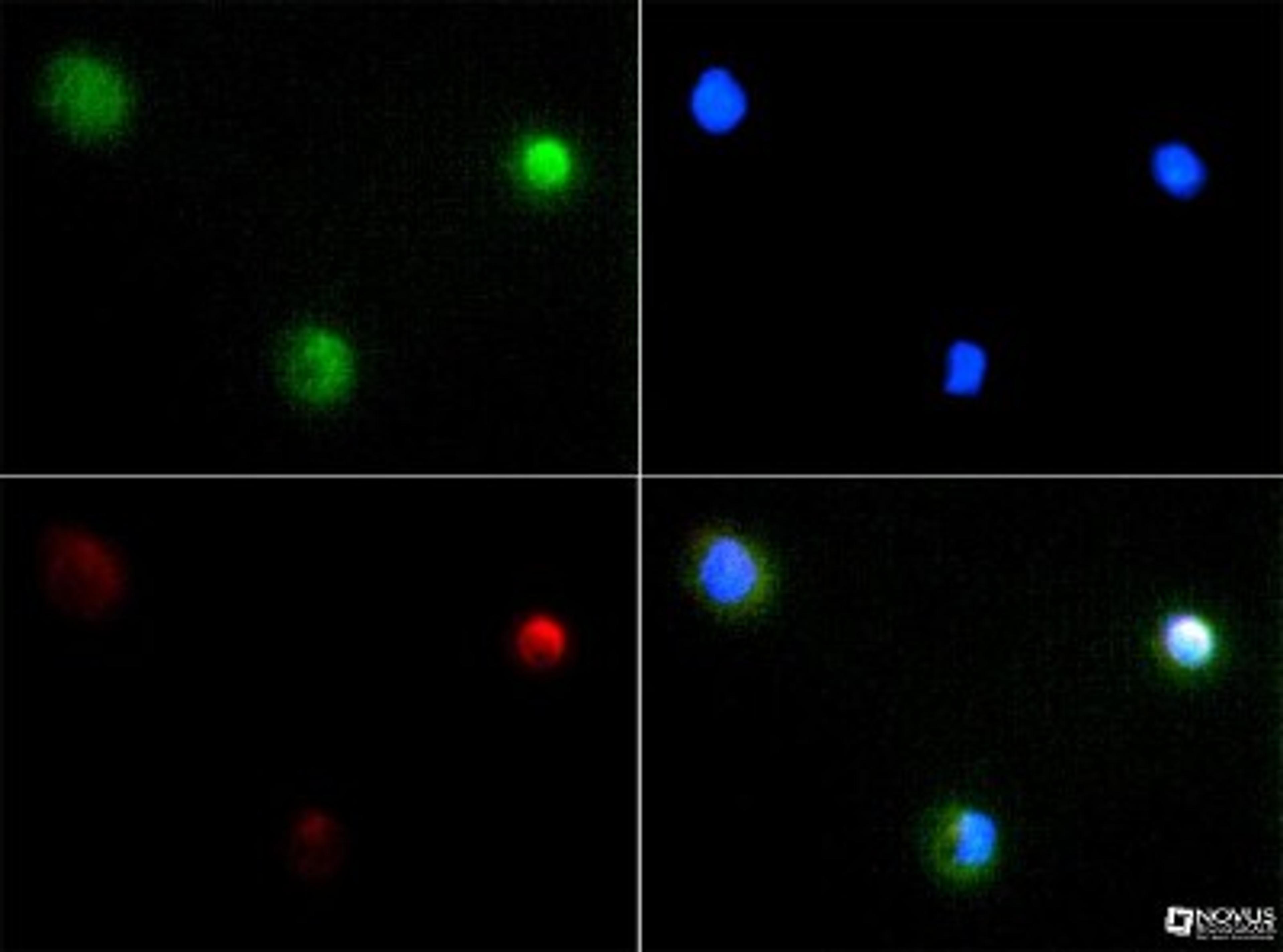 Immunocytochemistry/Immunofluorescence: PIEZO2 Antibody [NBP1-78538] - PIEZO2 antibody was tested at 1:100 in A431 cells with FITC (green). Nuclei and alpha-tubulin were counterstained with DAPI (blue) and Dylight 550 (red).