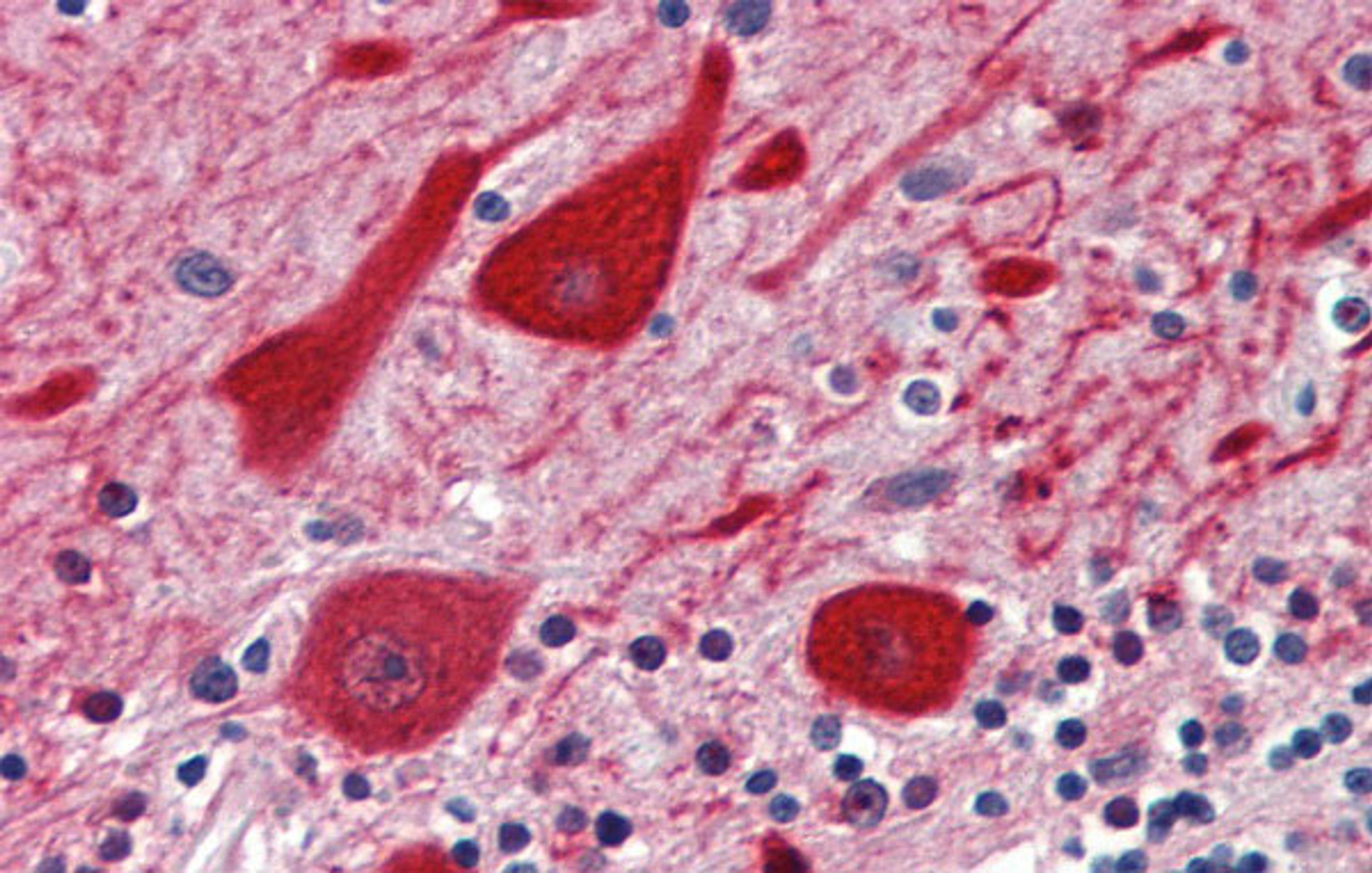 Antibody used in IHC on Human Brain, cerebellum at 5 ug/ml.