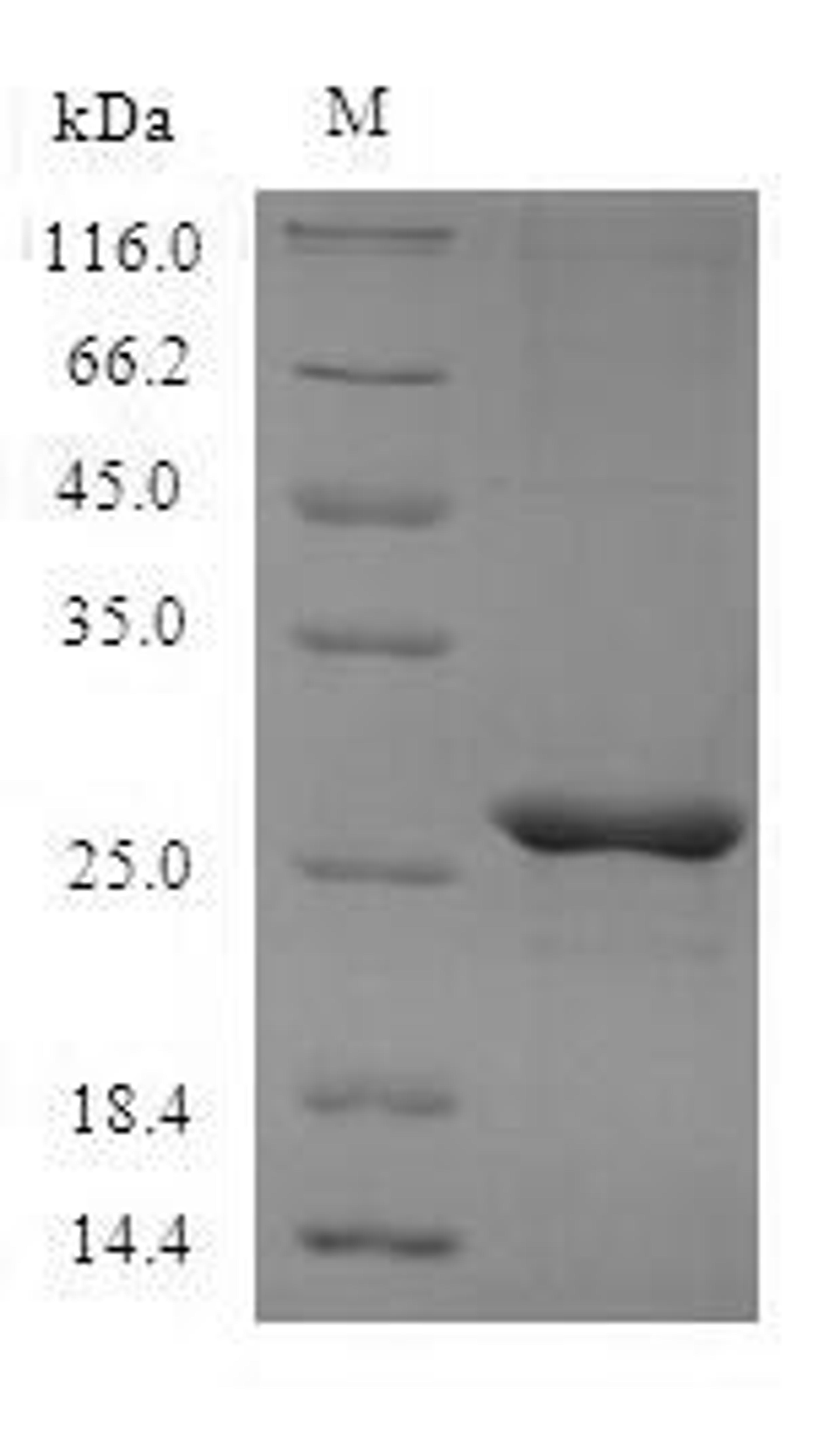 (Tris-Glycine gel) Discontinuous SDS-PAGE (reduced) with 5% enrichment gel and 15% separation gel.
