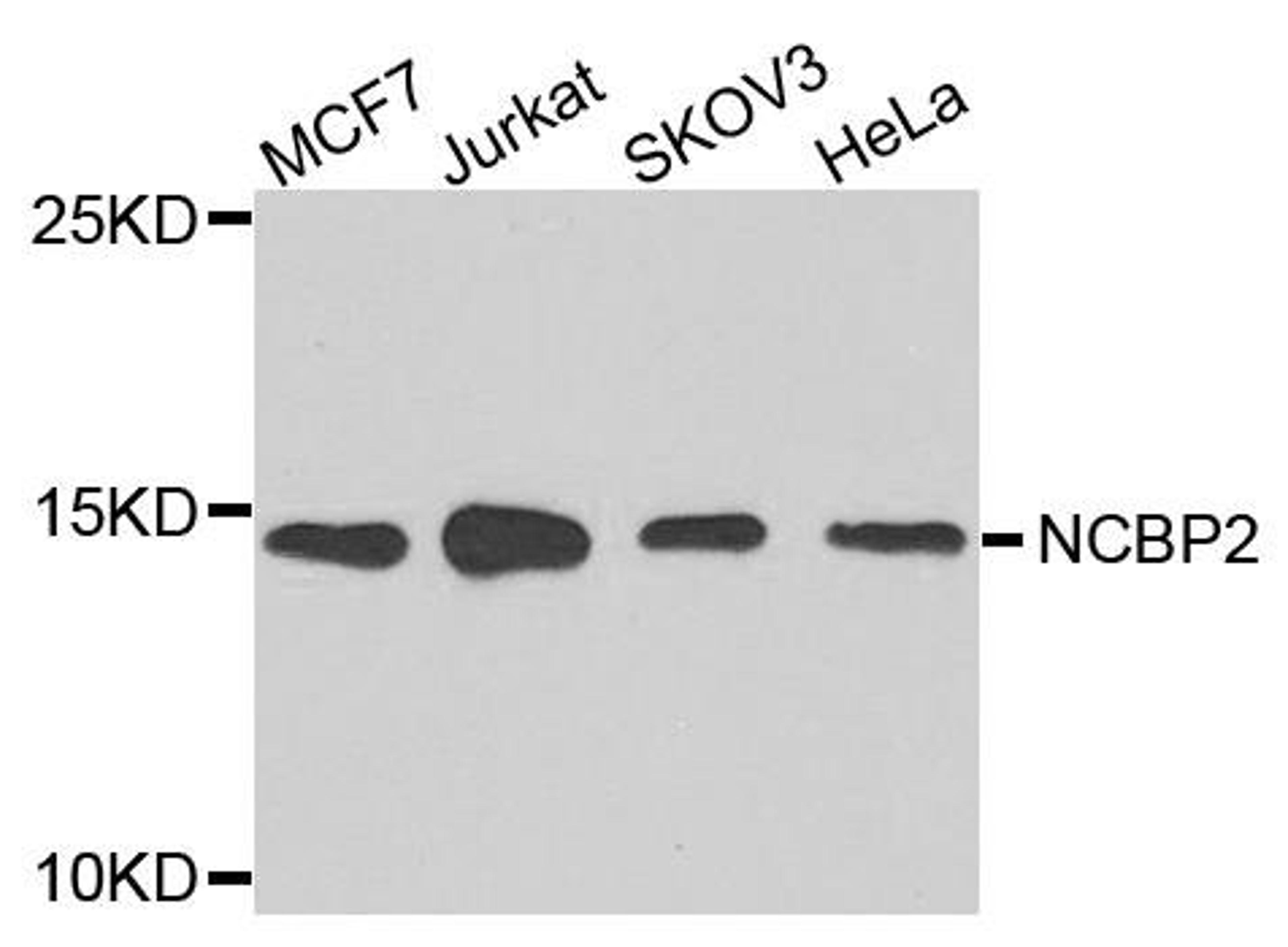 Western blot analysis of extracts of various cells using NCBP2 antibody